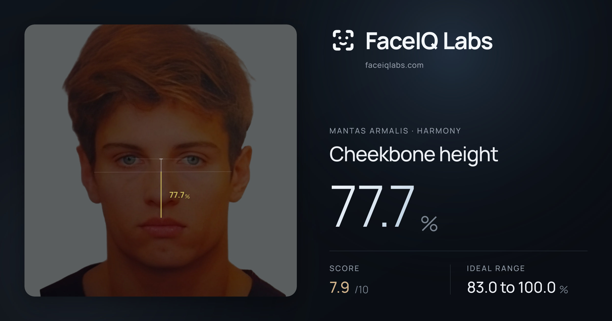 Mantas Armalis Cheekbone height: 77.7%, drawn on the photo