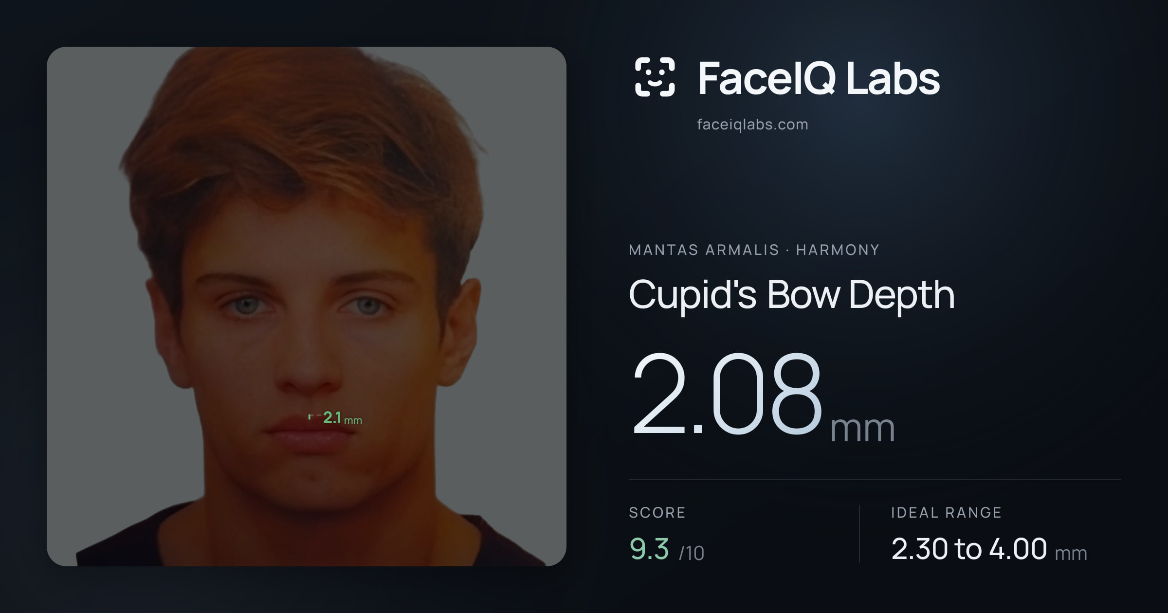 Mantas Armalis Cupid's Bow Depth: 2.08mm, drawn on the photo
