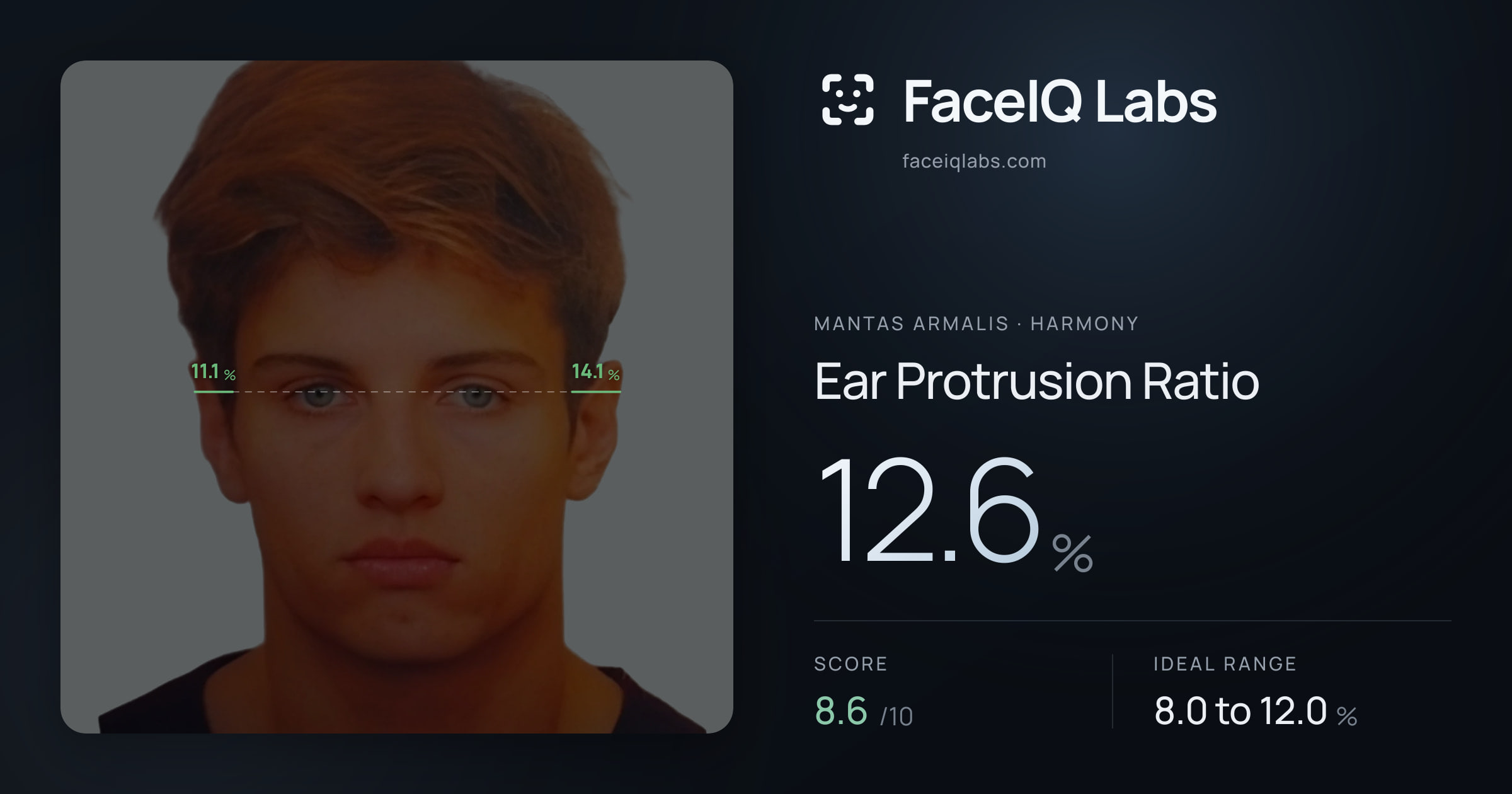 Mantas Armalis Ear Protrusion Ratio: 12.6%, drawn on the photo