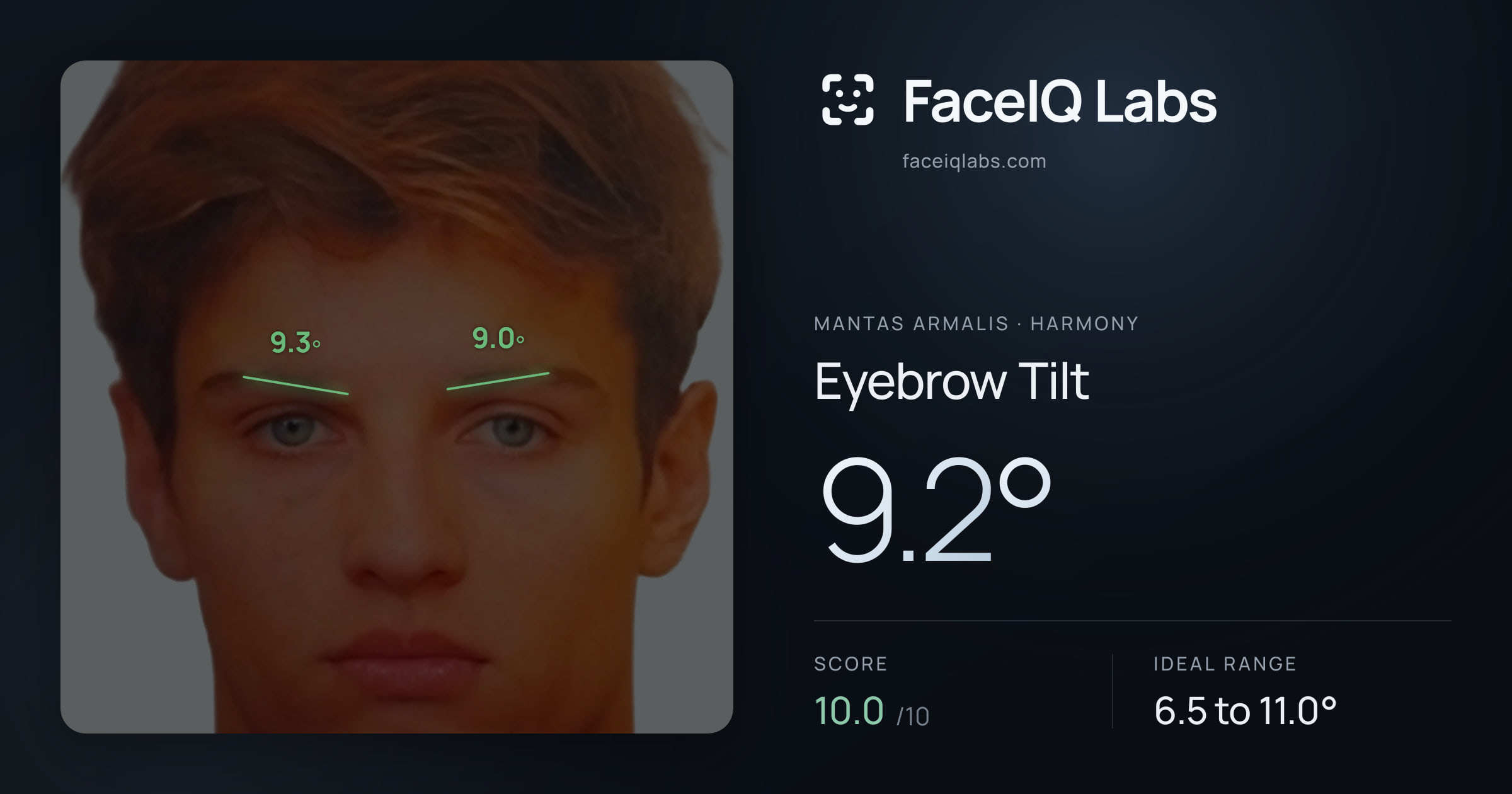Mantas Armalis Eyebrow Tilt: 9.2°, drawn on the photo