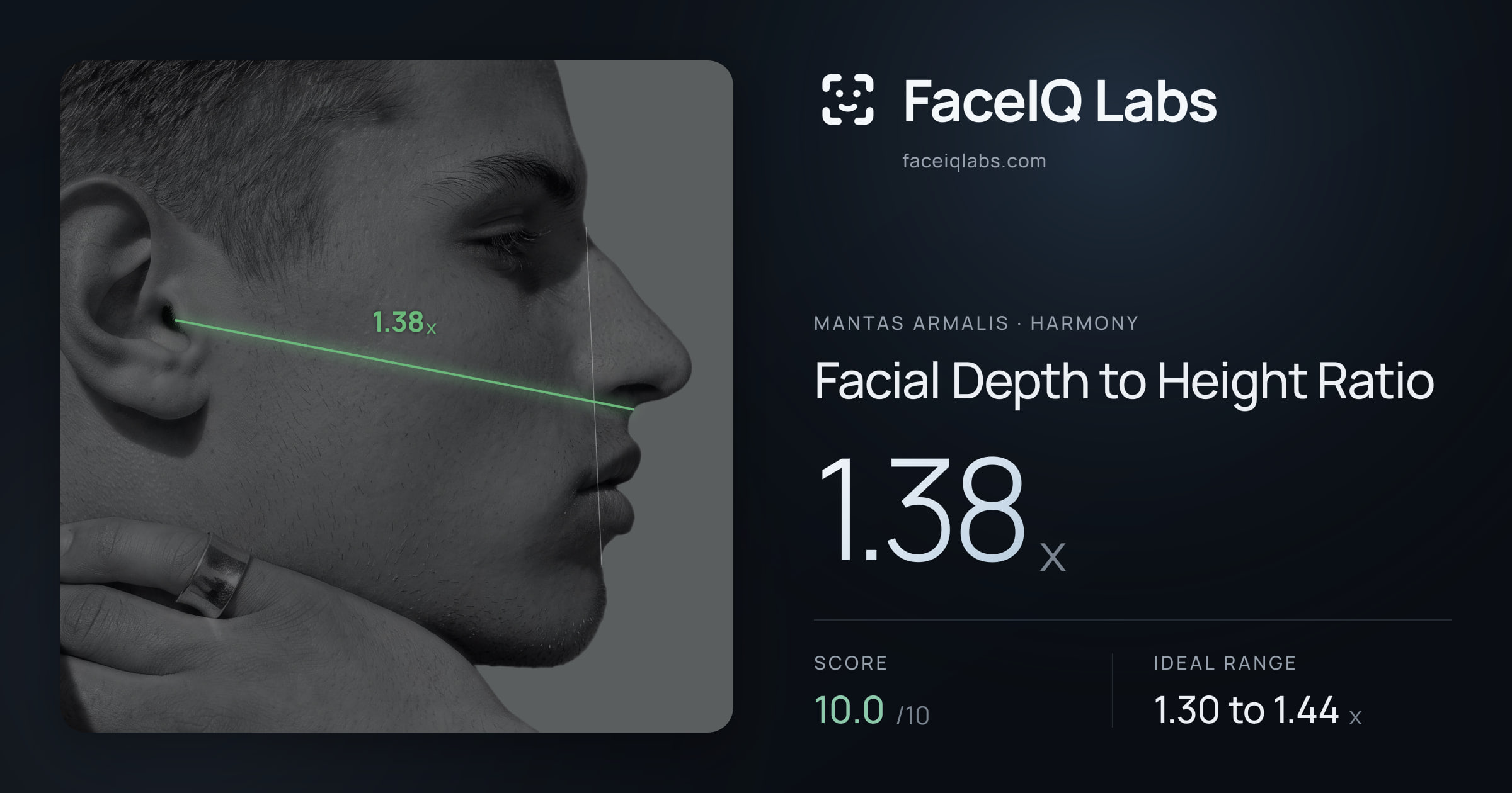 Mantas Armalis Facial Depth to Height Ratio: 1.38x, drawn on the photo