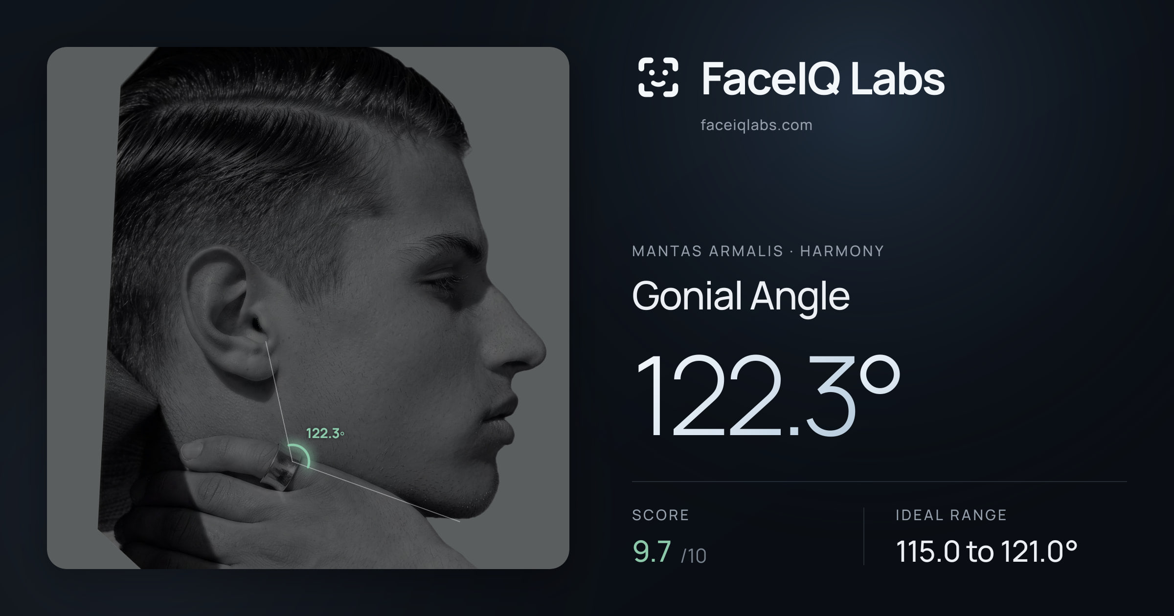 Mantas Armalis Gonial Angle: 122.3°, drawn on the photo