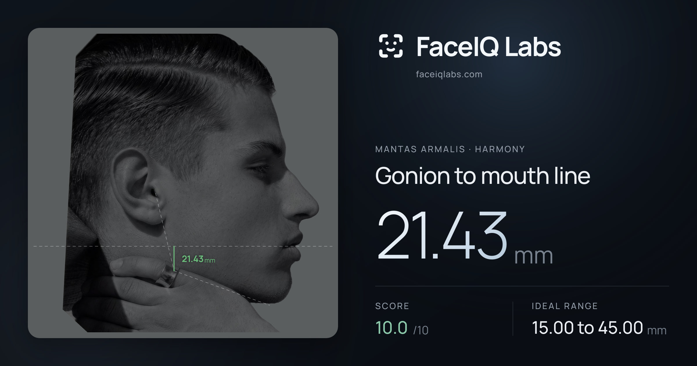 Mantas Armalis Gonion to mouth line: 21.43mm, drawn on the photo