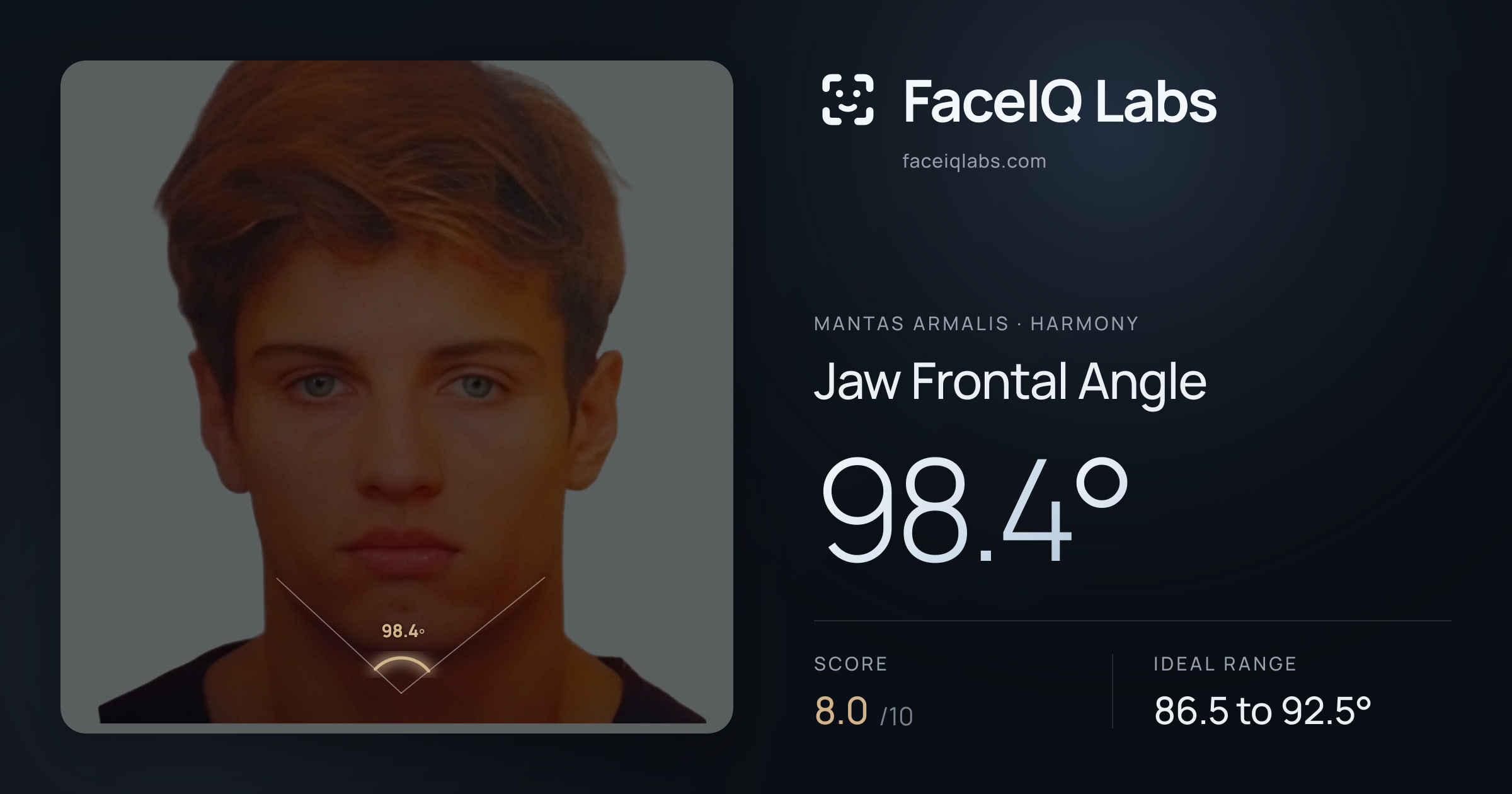 Mantas Armalis Jaw Frontal Angle: 98.4°, drawn on the photo