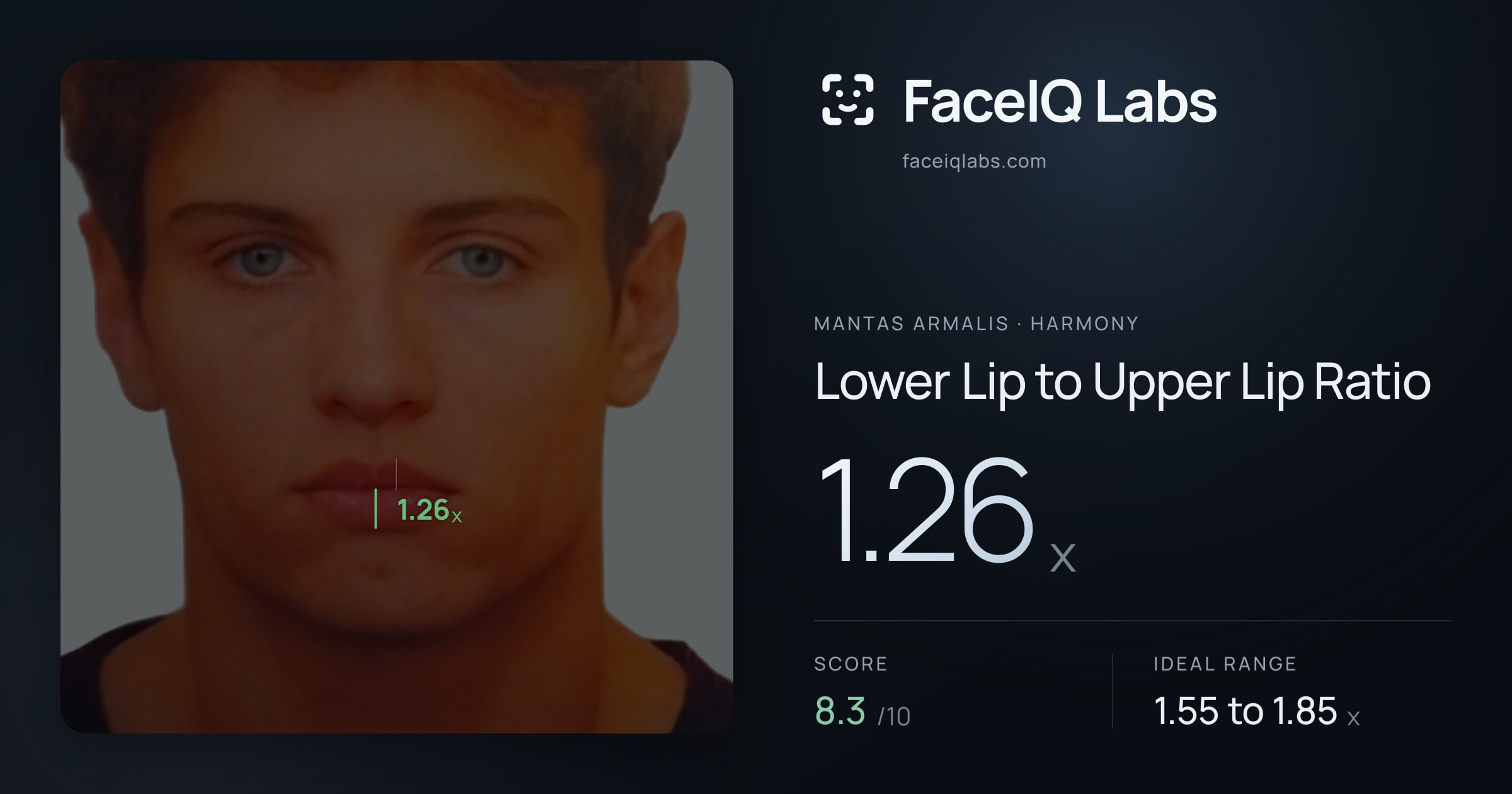 Mantas Armalis Lower Lip to Upper Lip Ratio: 1.26x, drawn on the photo