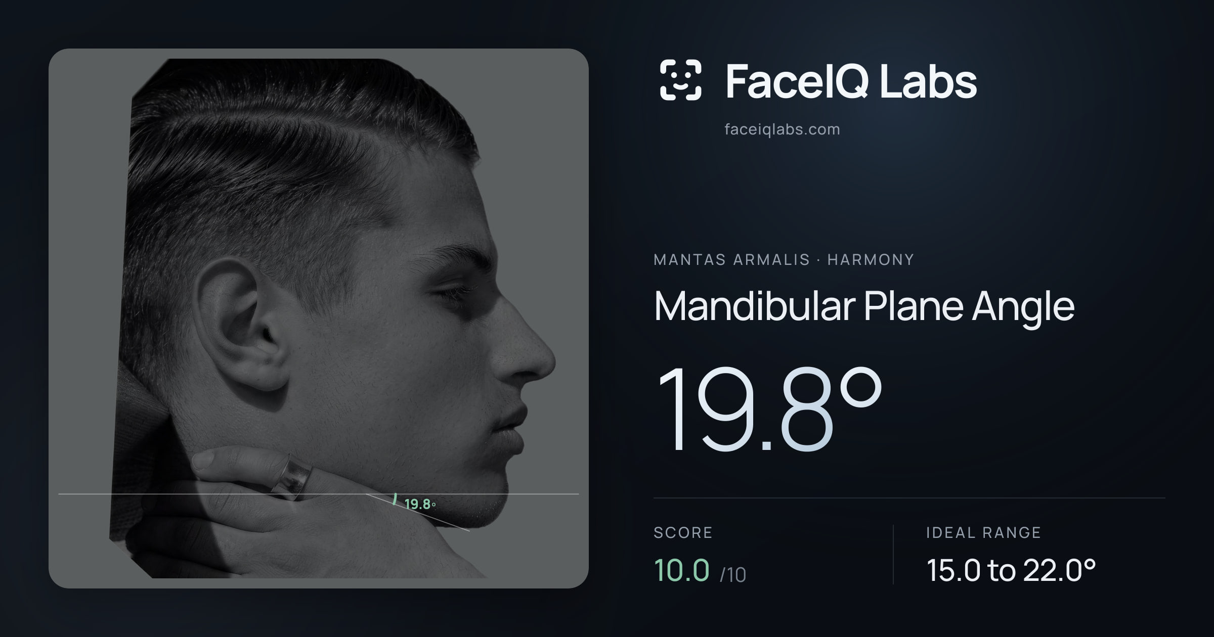 Mantas Armalis Mandibular Plane Angle: 19.8°, drawn on the photo