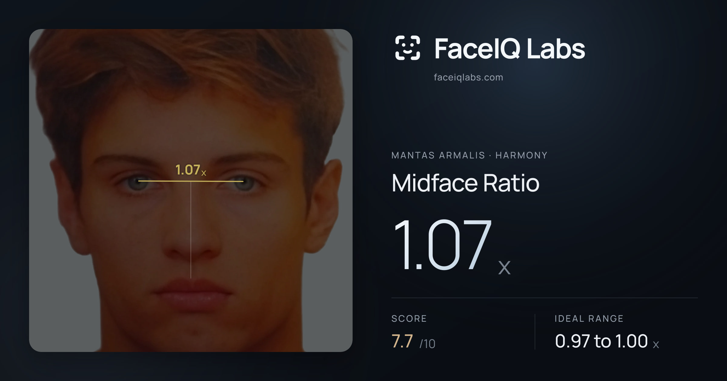 Mantas Armalis Midface Ratio: 1.07x, drawn on the photo