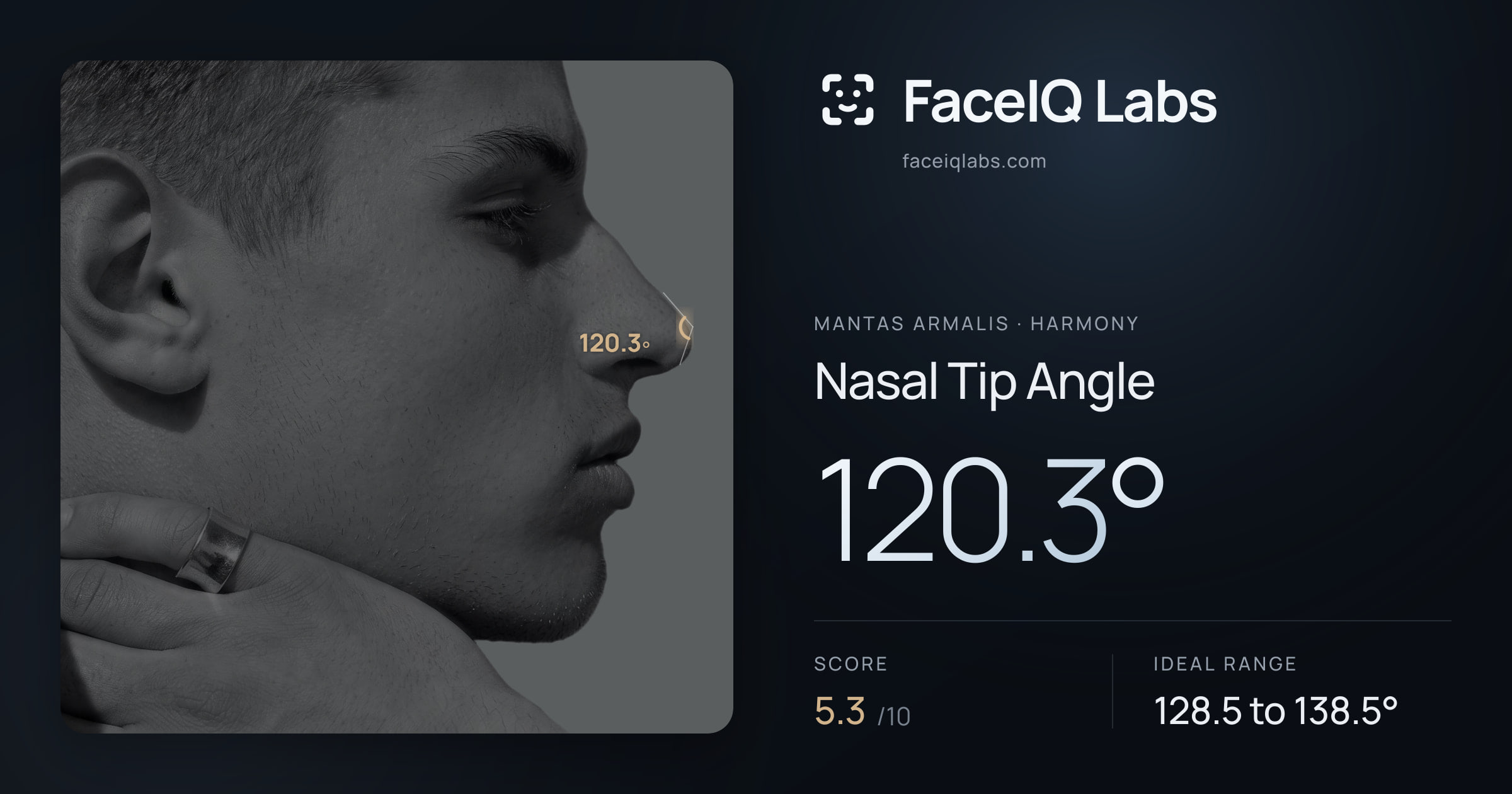 Mantas Armalis Nasal Tip Angle: 120.3°, drawn on the photo