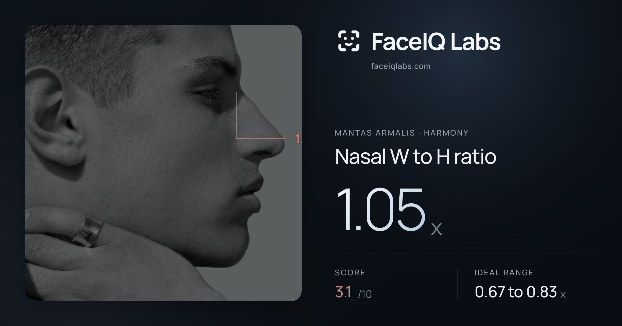 Mantas Armalis Nasal W to H ratio: 1.05x, drawn on the photo