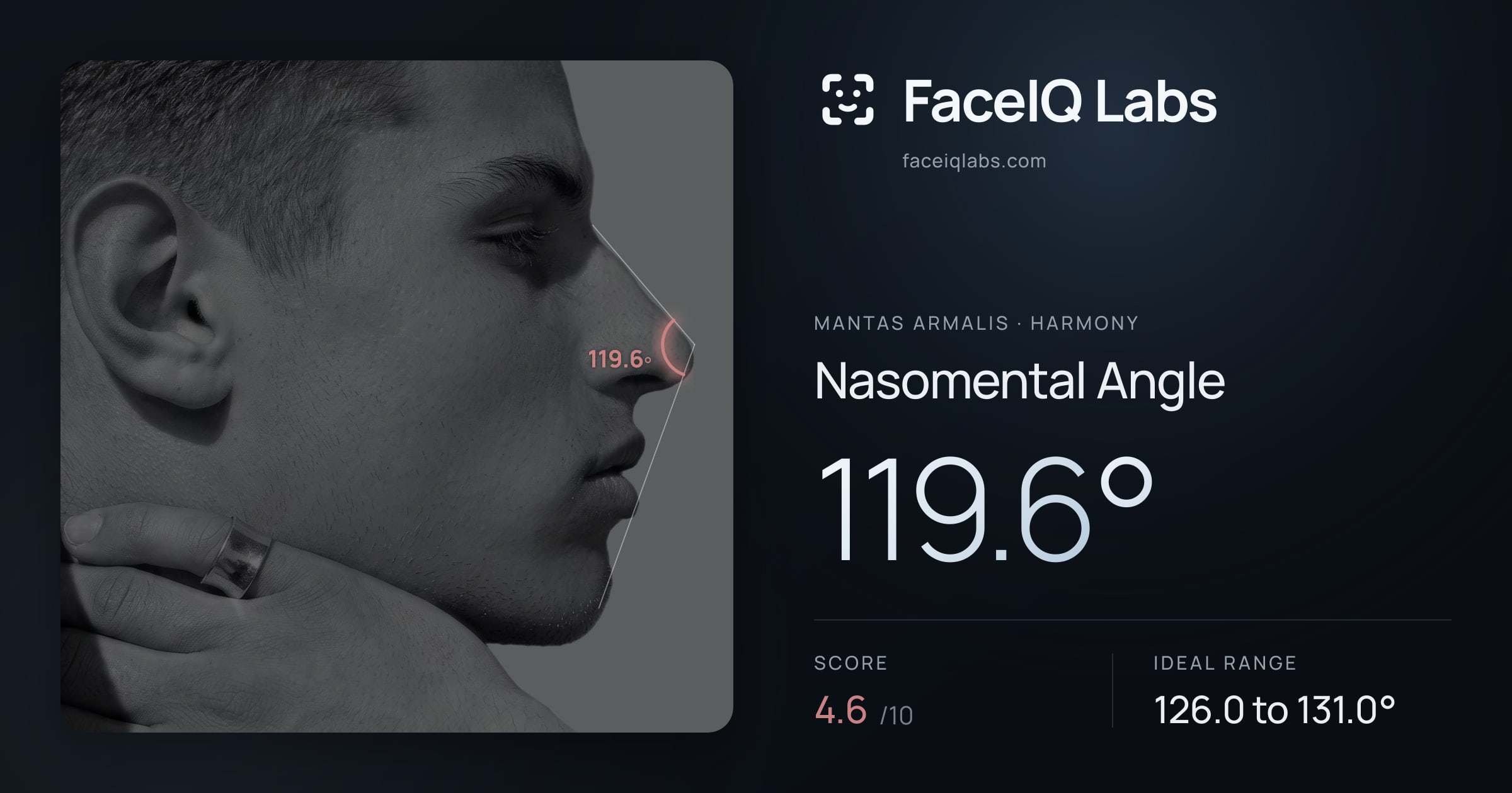 Mantas Armalis Nasomental Angle: 119.6°, drawn on the photo