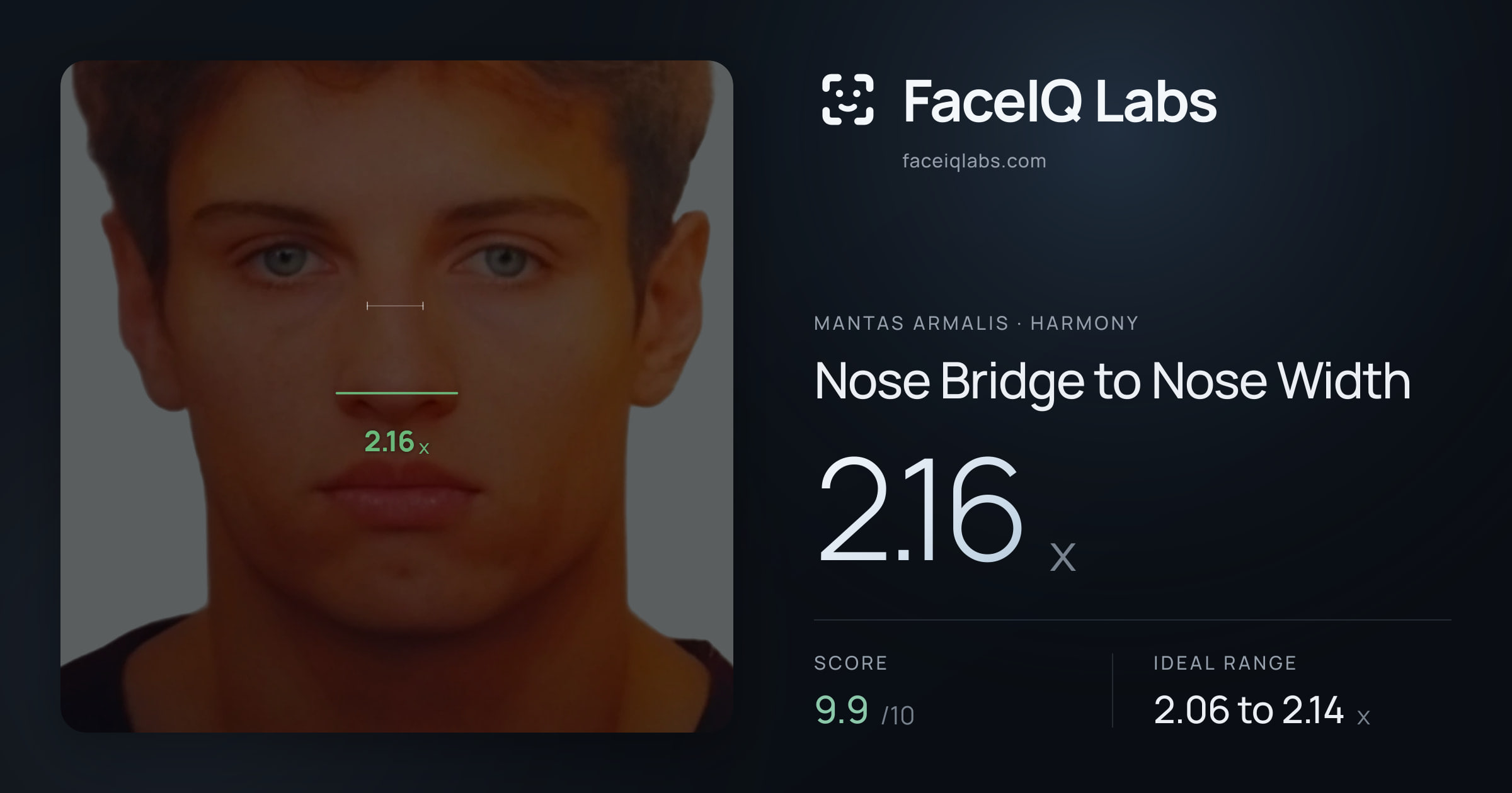 Mantas Armalis Nose Bridge to Nose Width: 2.16x, drawn on the photo