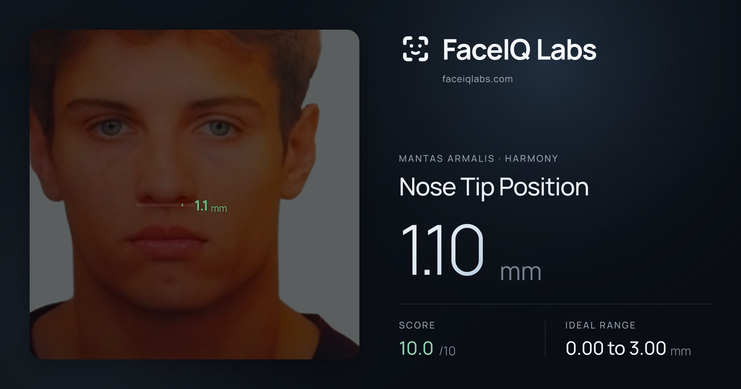 Mantas Armalis Nose Tip Position: 1.10mm, drawn on the photo