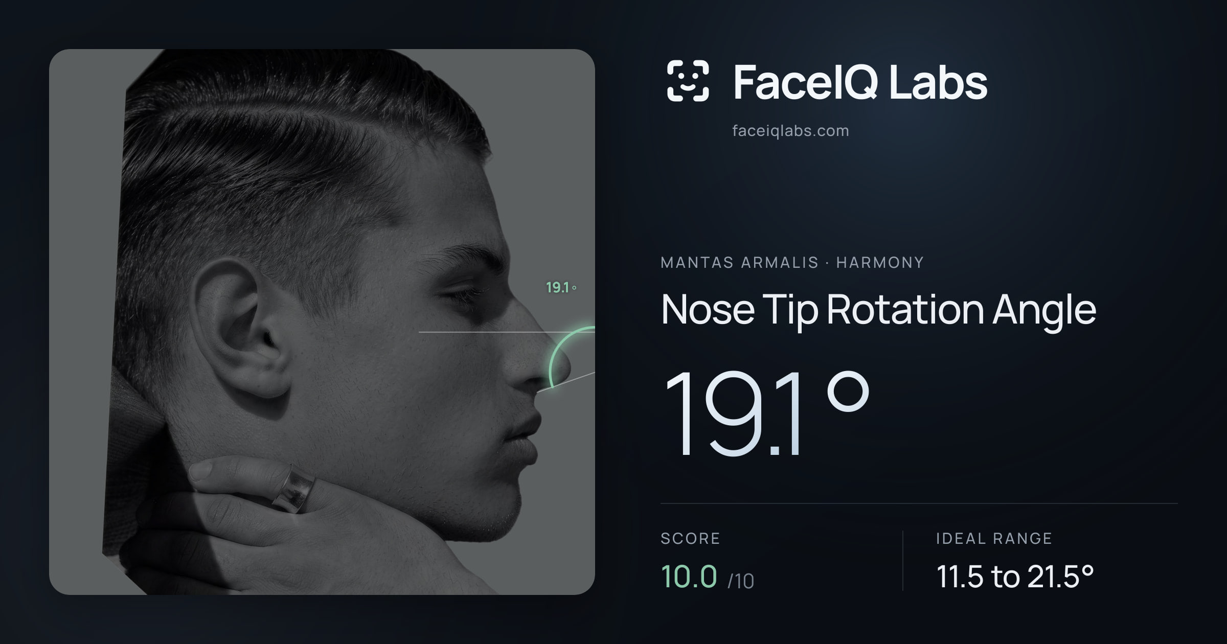Mantas Armalis Nose Tip Rotation Angle: 19.1°, drawn on the photo
