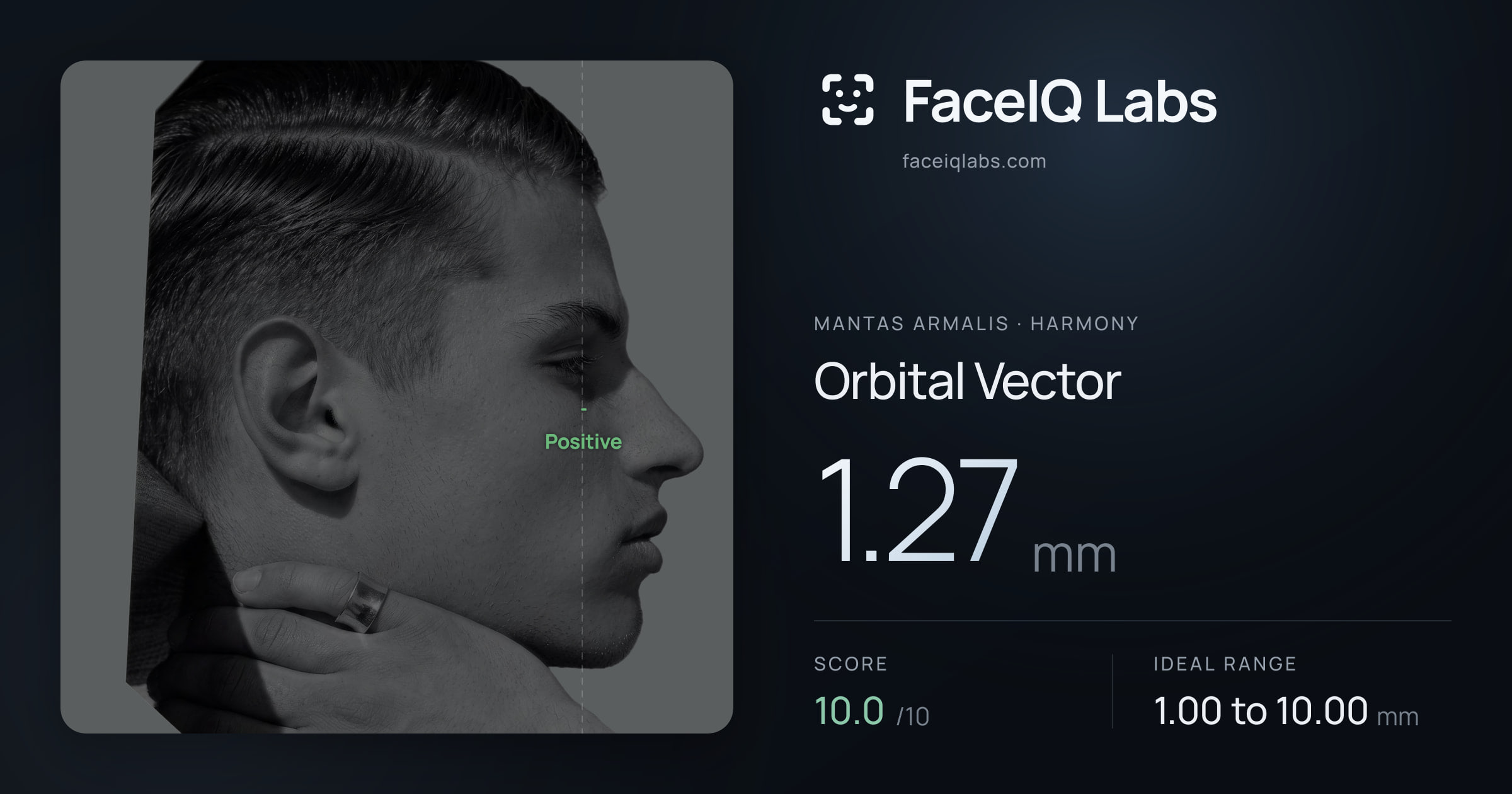 Mantas Armalis Orbital Vector: 1.27mm, drawn on the photo