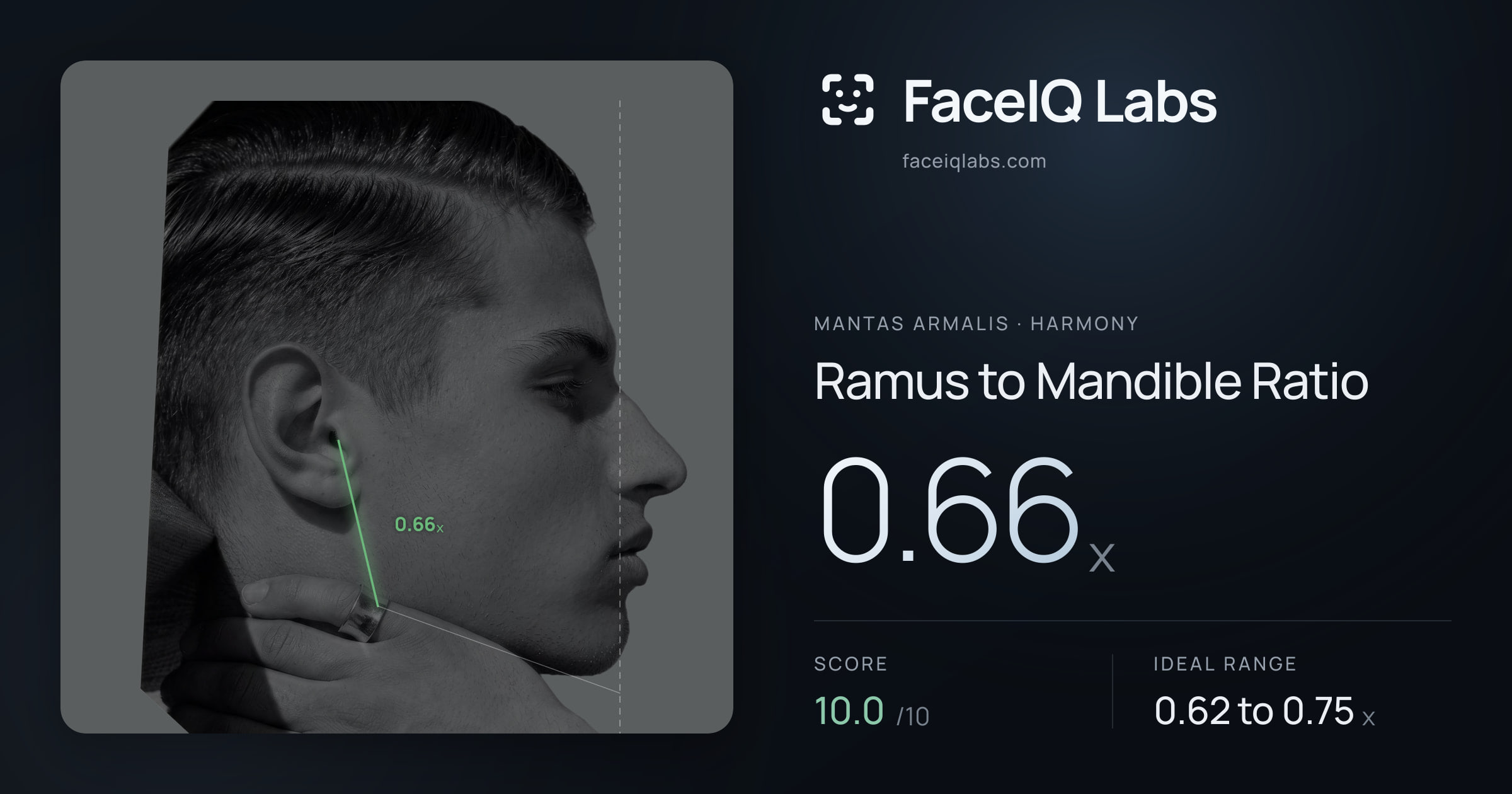 Mantas Armalis Ramus to Mandible Ratio: 0.66x, drawn on the photo