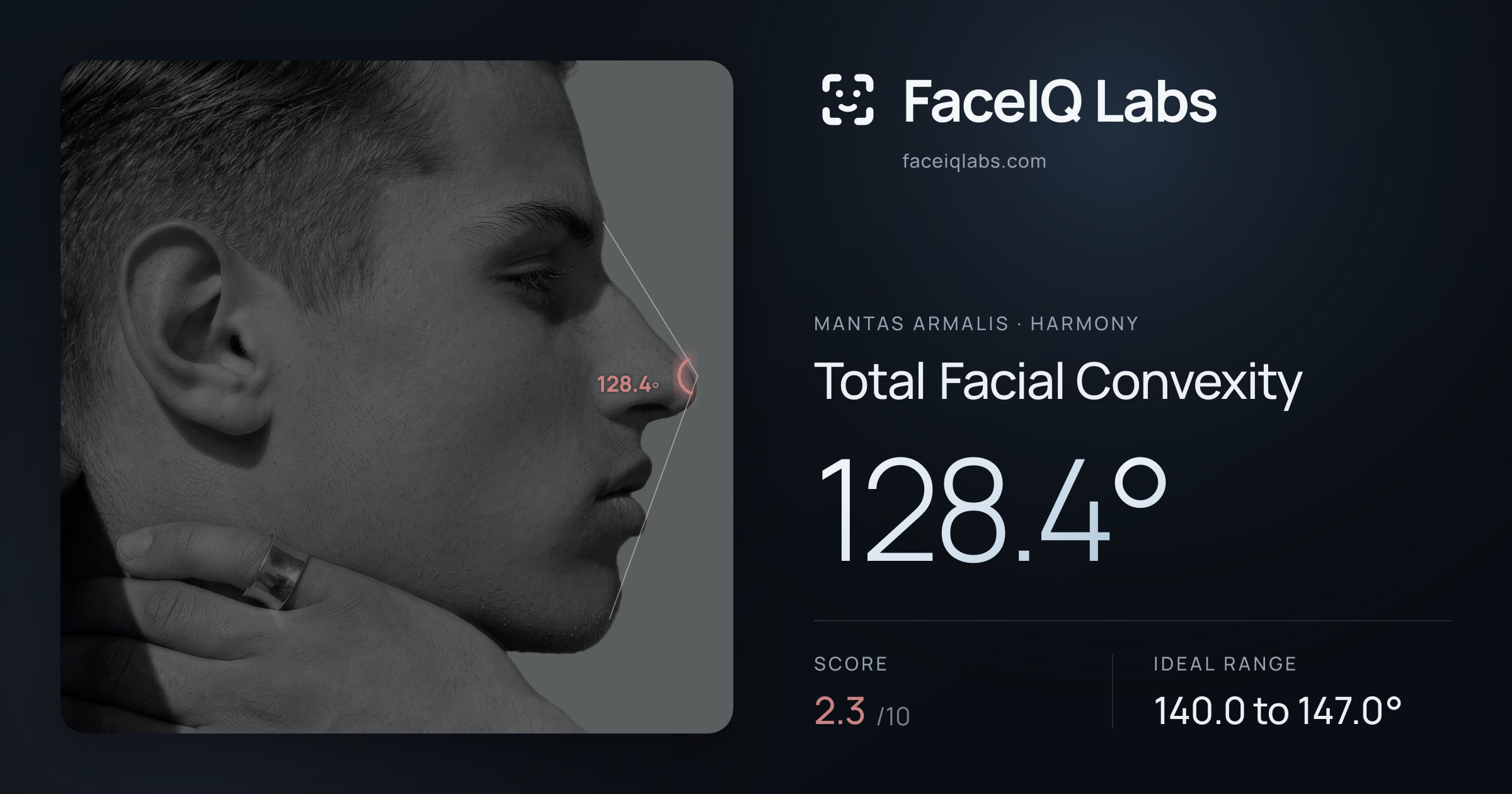 Mantas Armalis Total Facial Convexity: 128.4°, drawn on the photo
