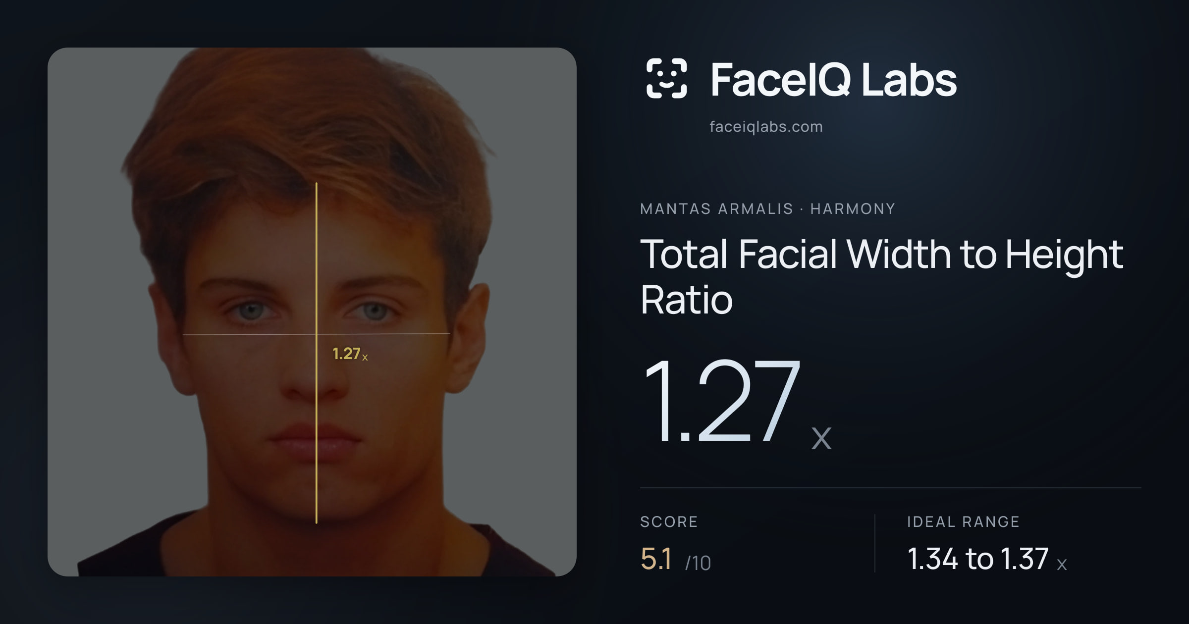 Mantas Armalis Total Facial Width to Height Ratio: 1.27x, drawn on the photo