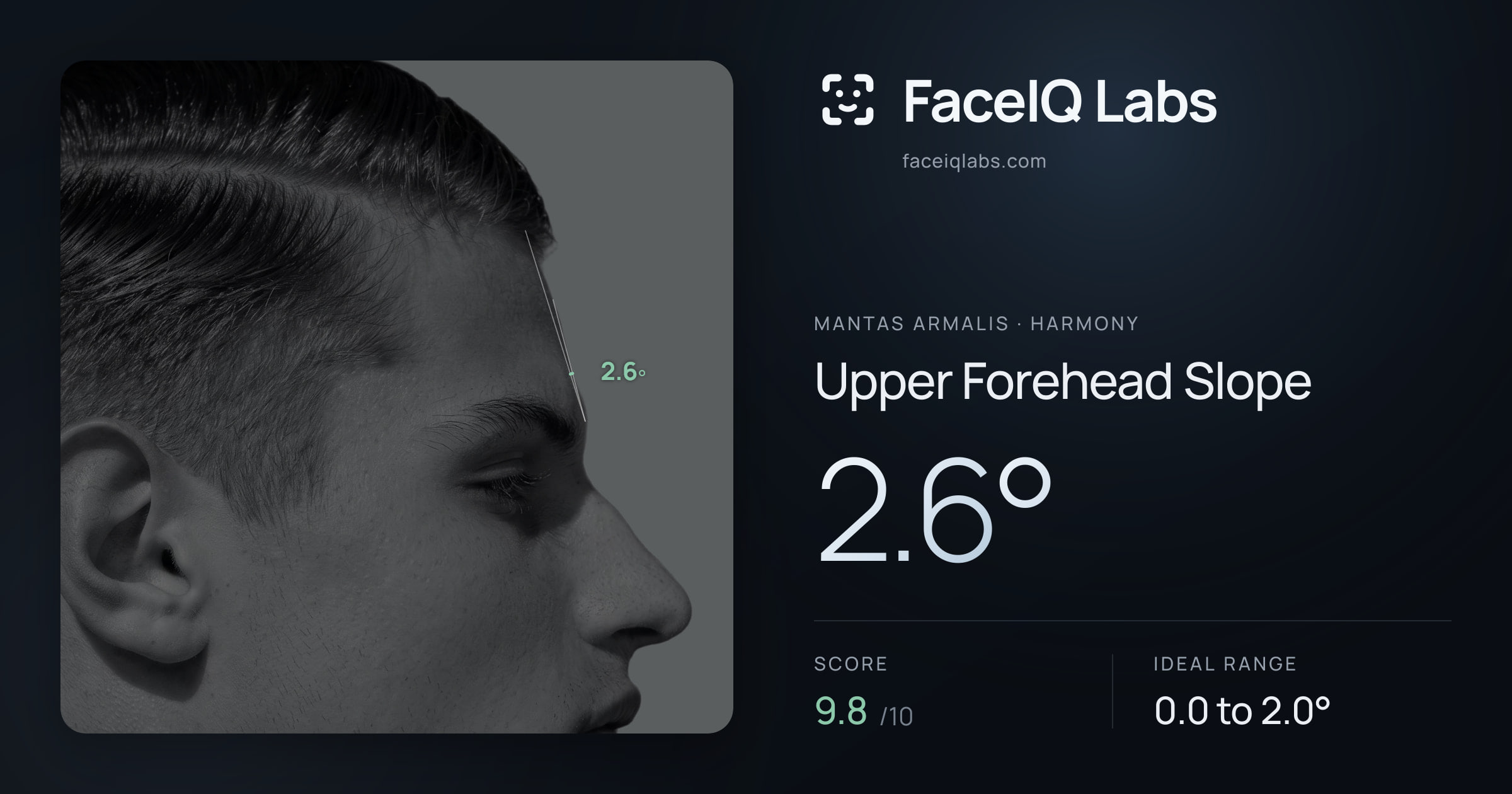 Mantas Armalis Upper Forehead Slope: 2.6°, drawn on the photo