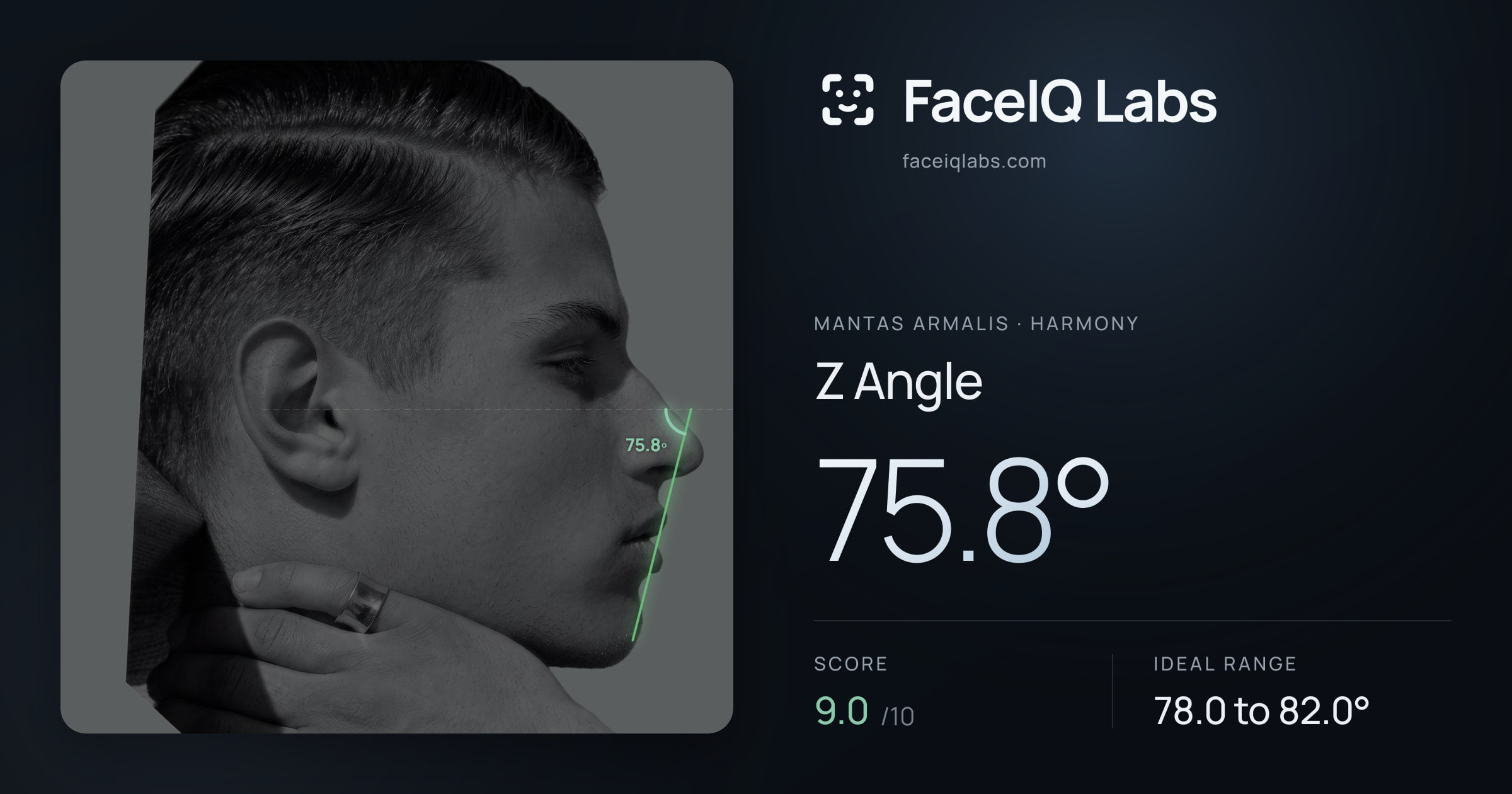 Mantas Armalis Z Angle: 75.8°, drawn on the photo