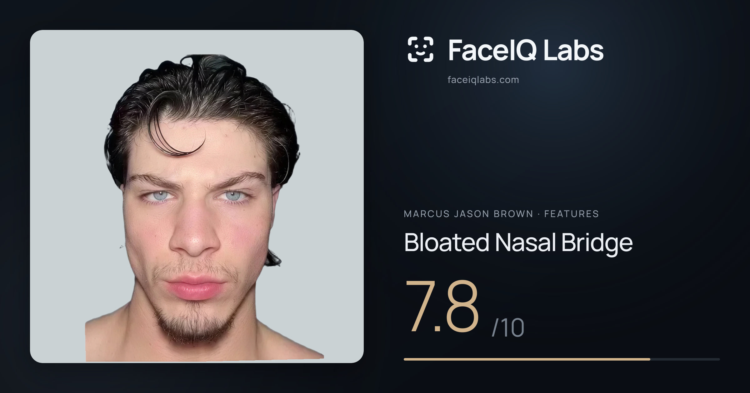 Marcus Jason Brown Bloated Nasal Bridge: 7.8/10, drawn on the photo