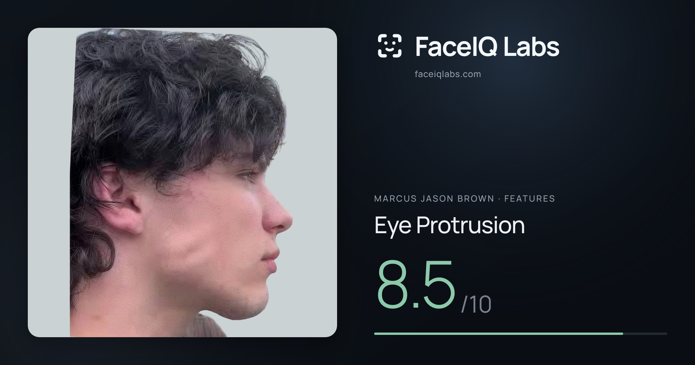 Marcus Jason Brown Eye Protrusion: 8.5/10, drawn on the photo
