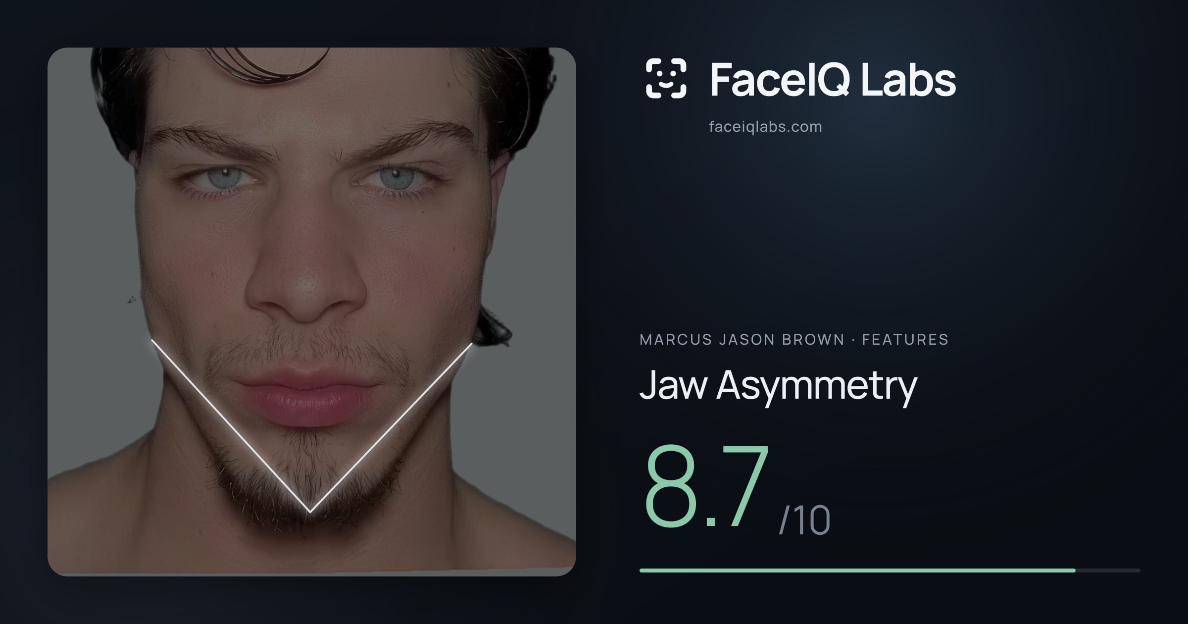 Marcus Jason Brown Jaw Asymmetry: 8.7/10, drawn on the photo