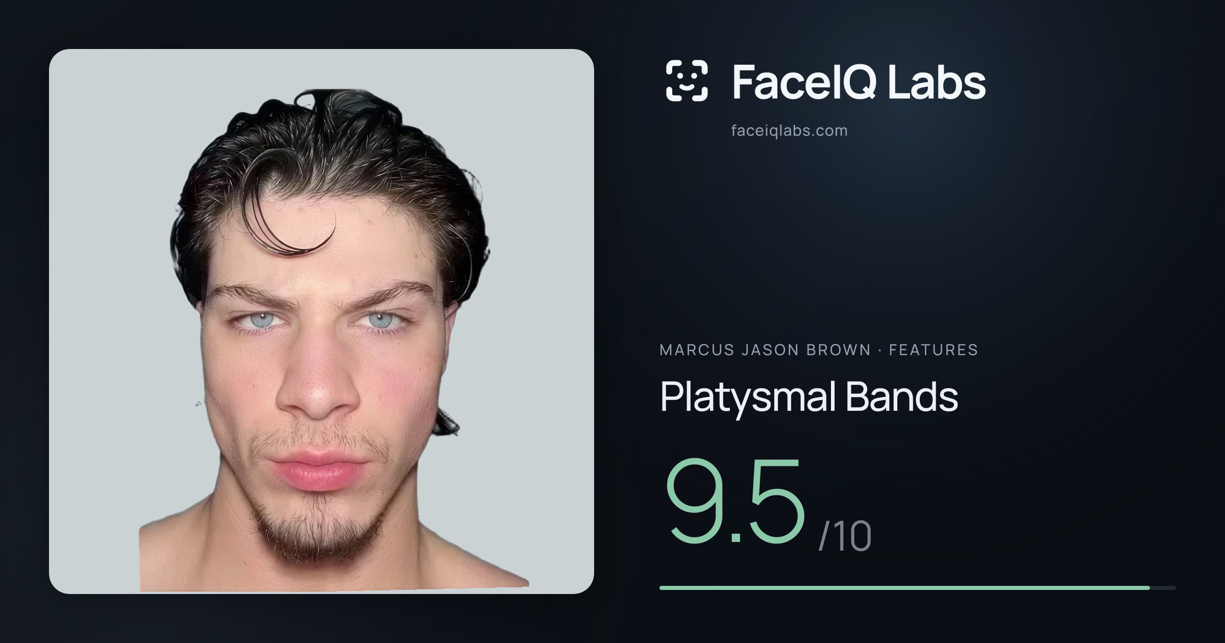 Marcus Jason Brown Platysmal Bands: 9.5/10, drawn on the photo