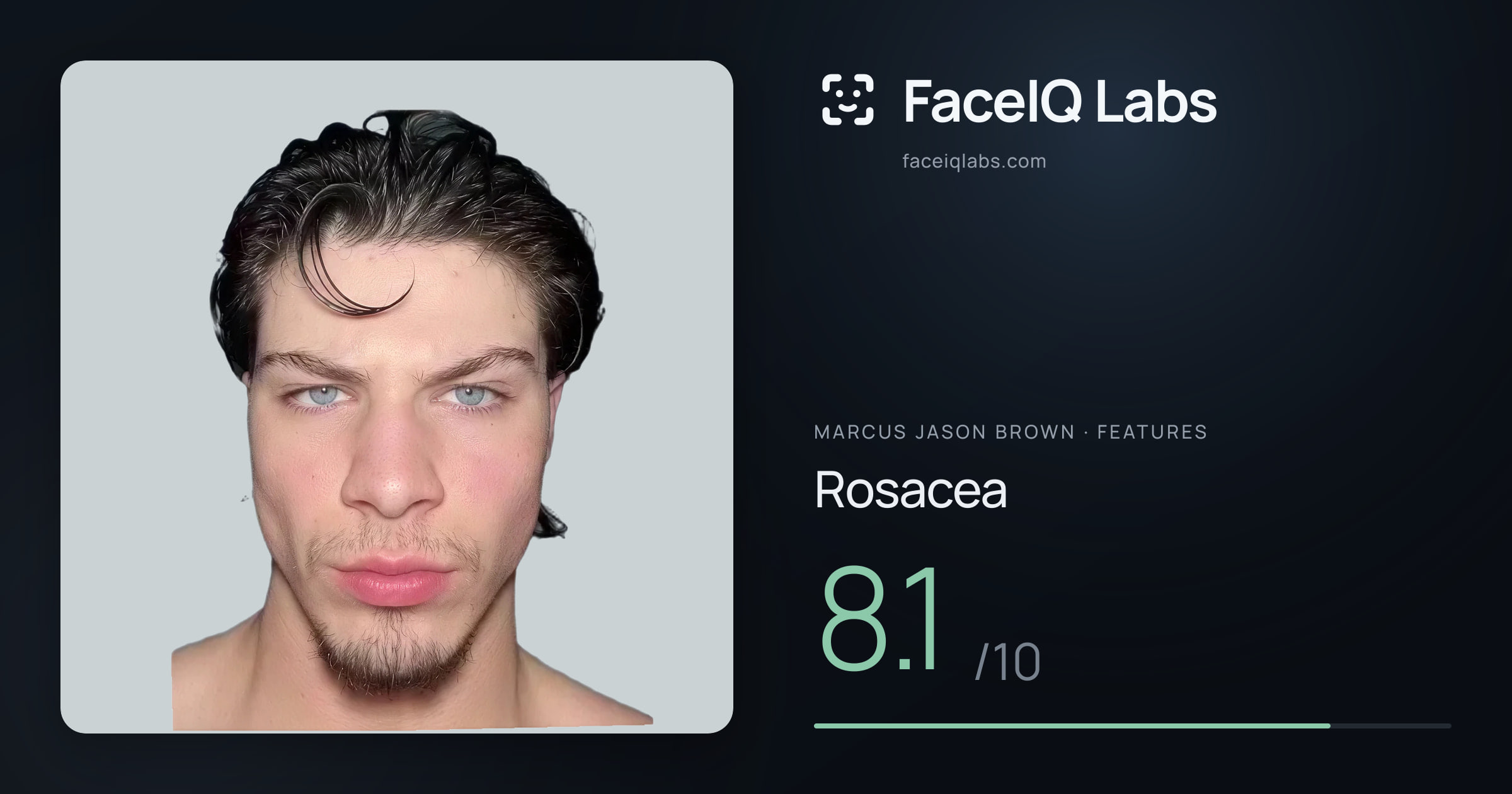 Marcus Jason Brown Rosacea: 8.1/10, drawn on the photo