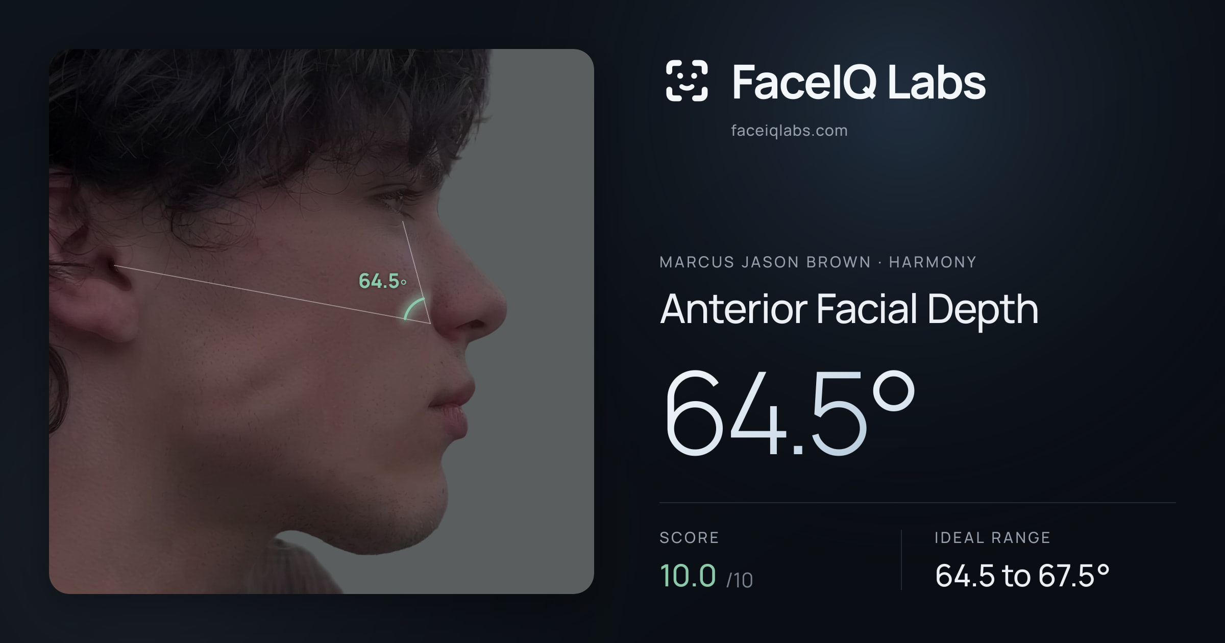 Marcus Jason Brown Anterior Facial Depth: 64.5°, drawn on the photo