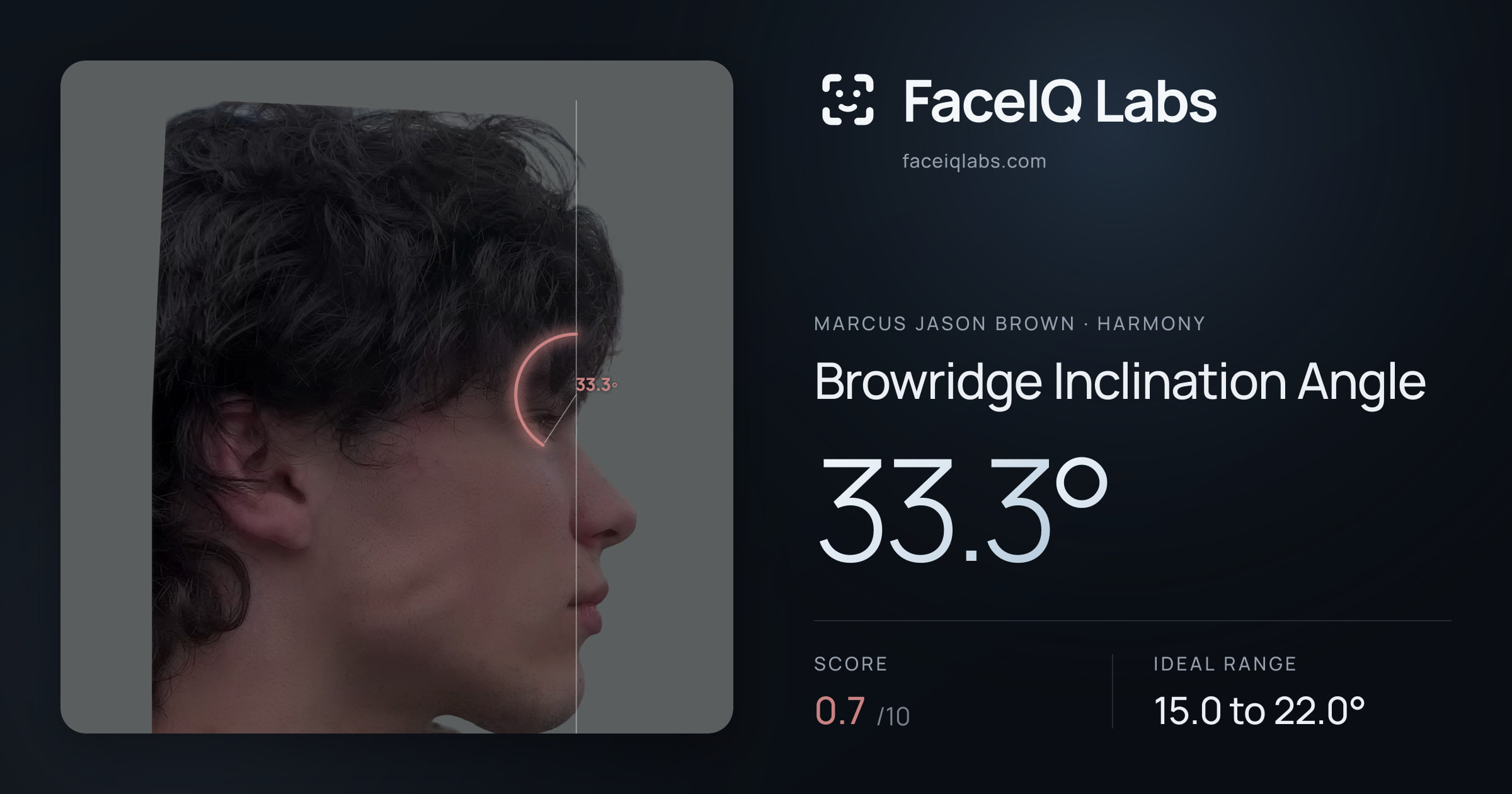 Marcus Jason Brown Browridge Inclination Angle: 33.3°, drawn on the photo