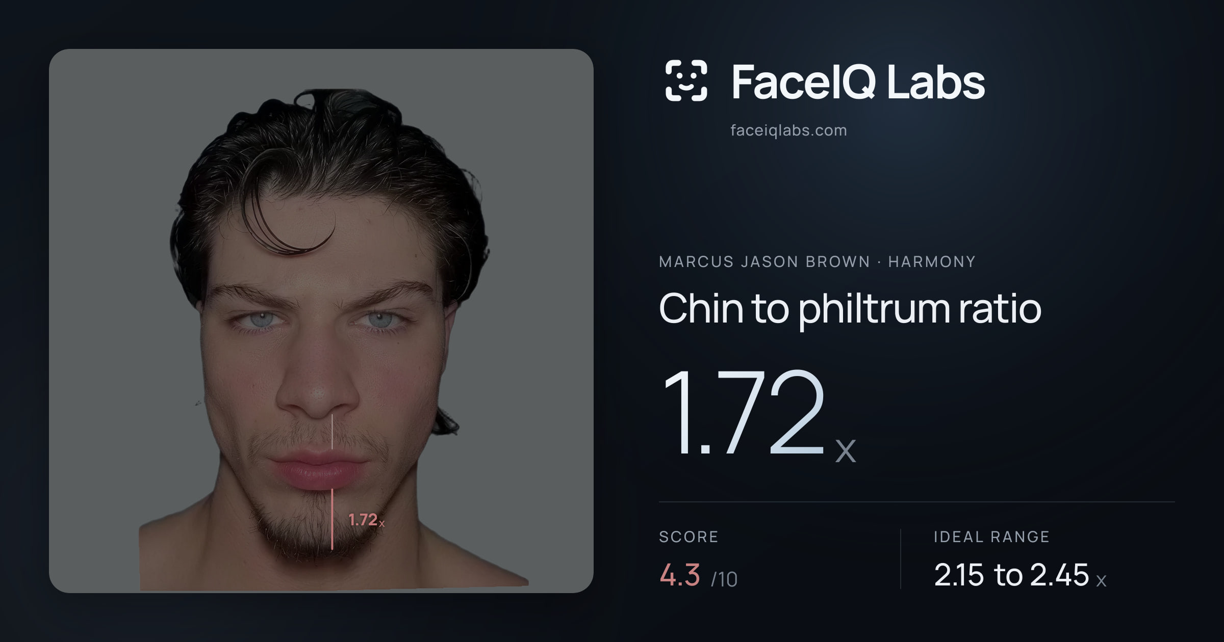 Marcus Jason Brown Chin to philtrum ratio: 1.72x, drawn on the photo