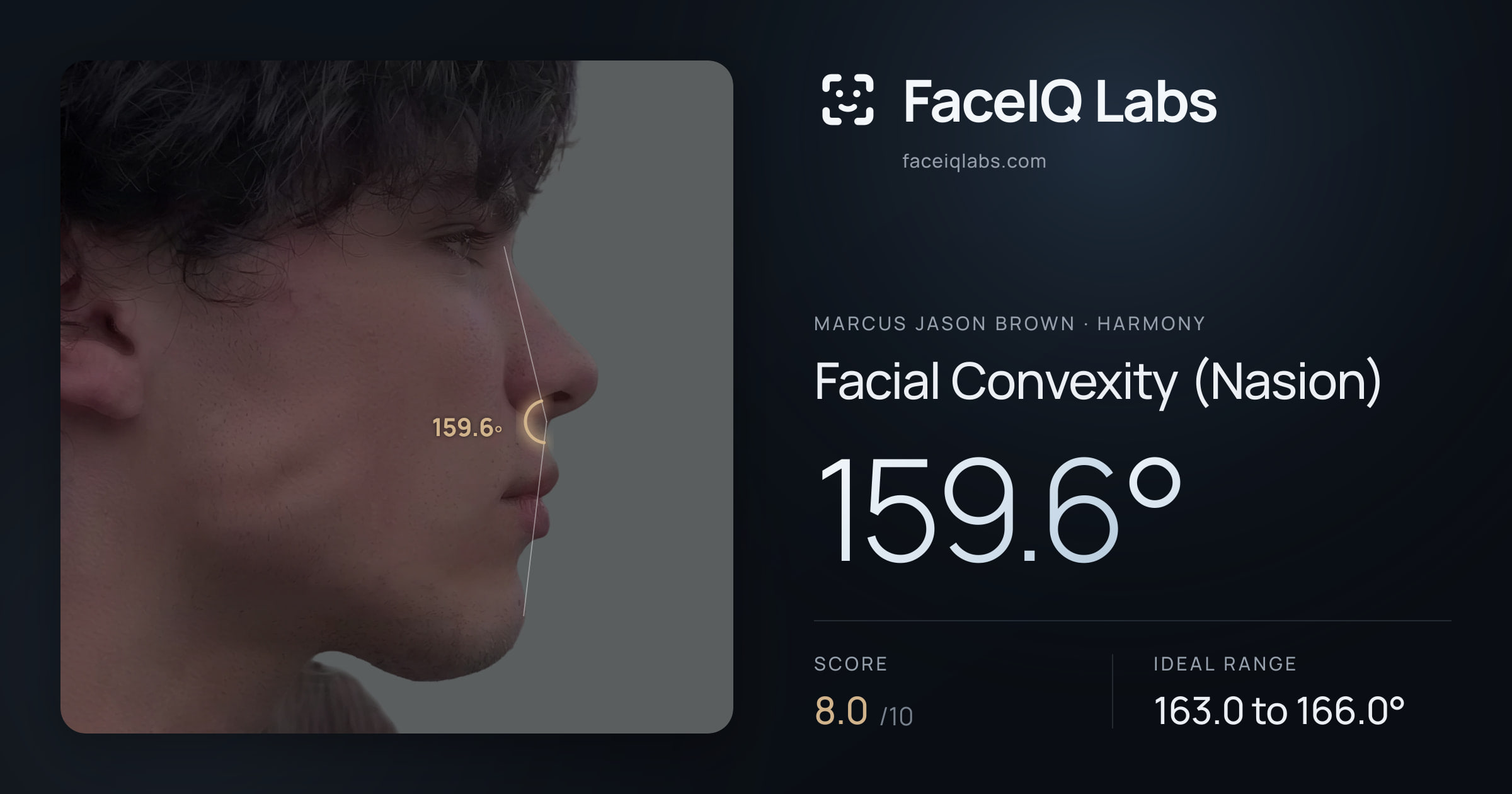 Marcus Jason Brown Facial Convexity (Nasion): 159.6°, drawn on the photo