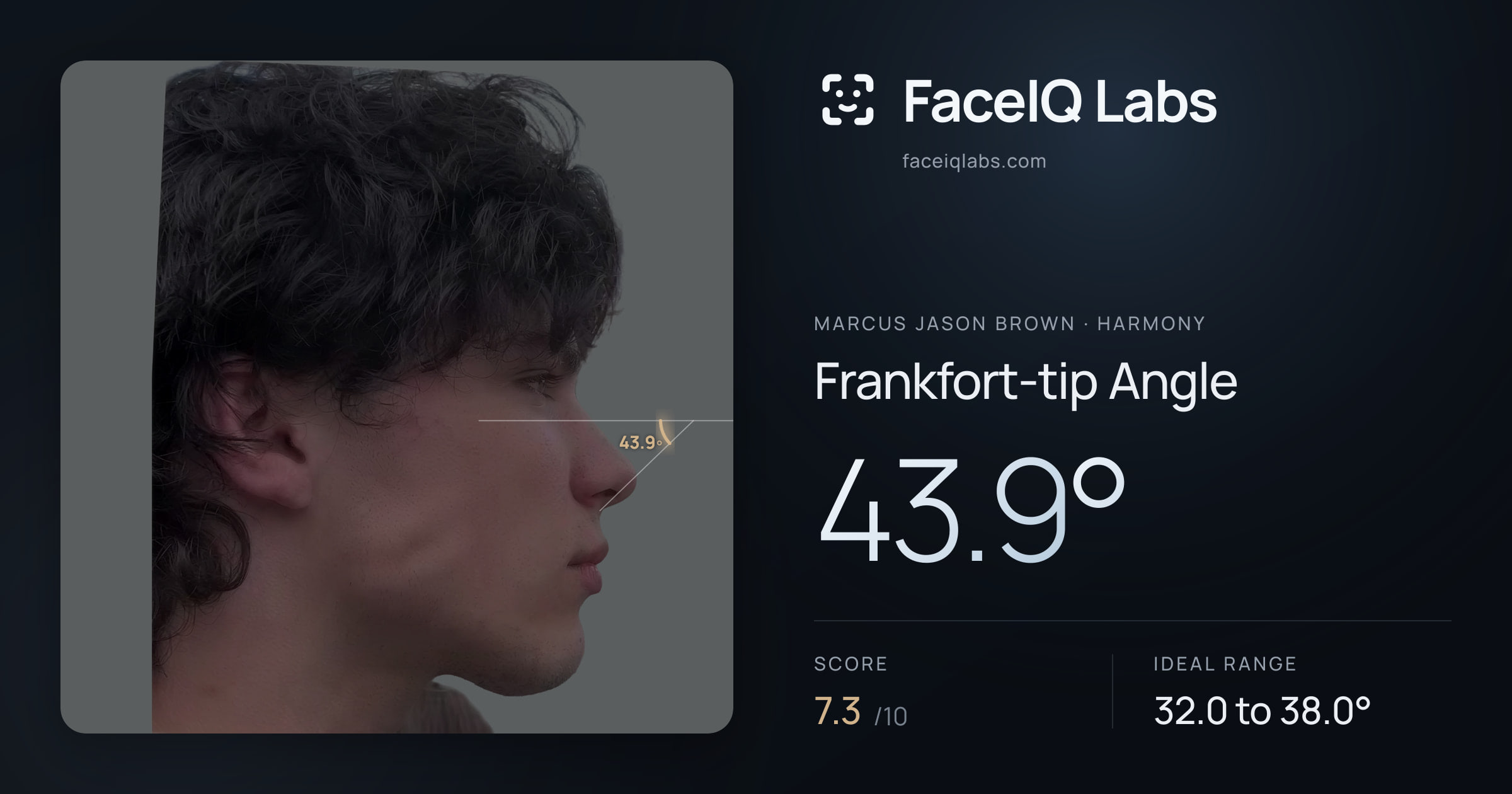 Marcus Jason Brown Frankfort-tip Angle: 43.9°, drawn on the photo