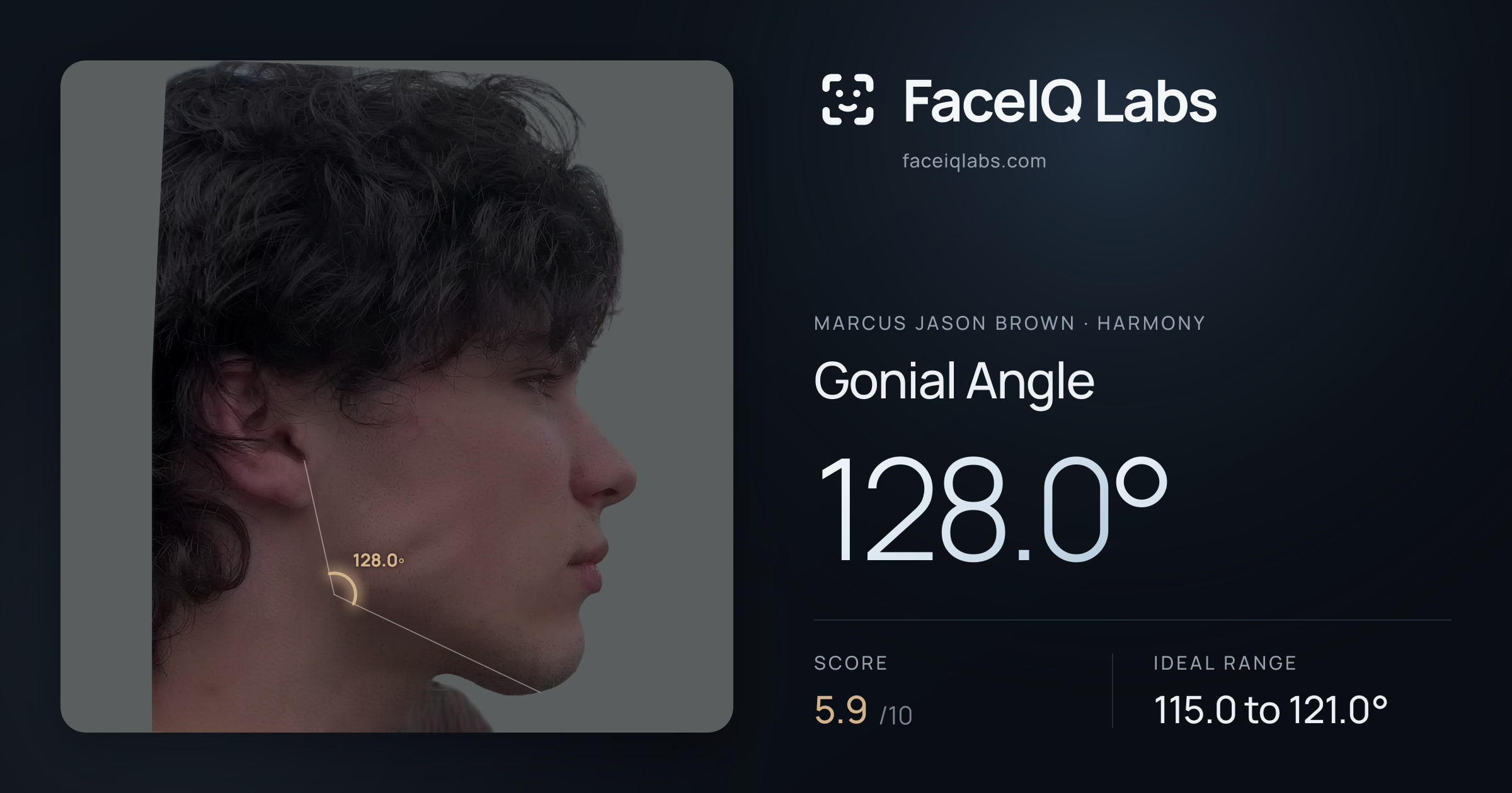 Marcus Jason Brown Gonial Angle: 128.0°, drawn on the photo