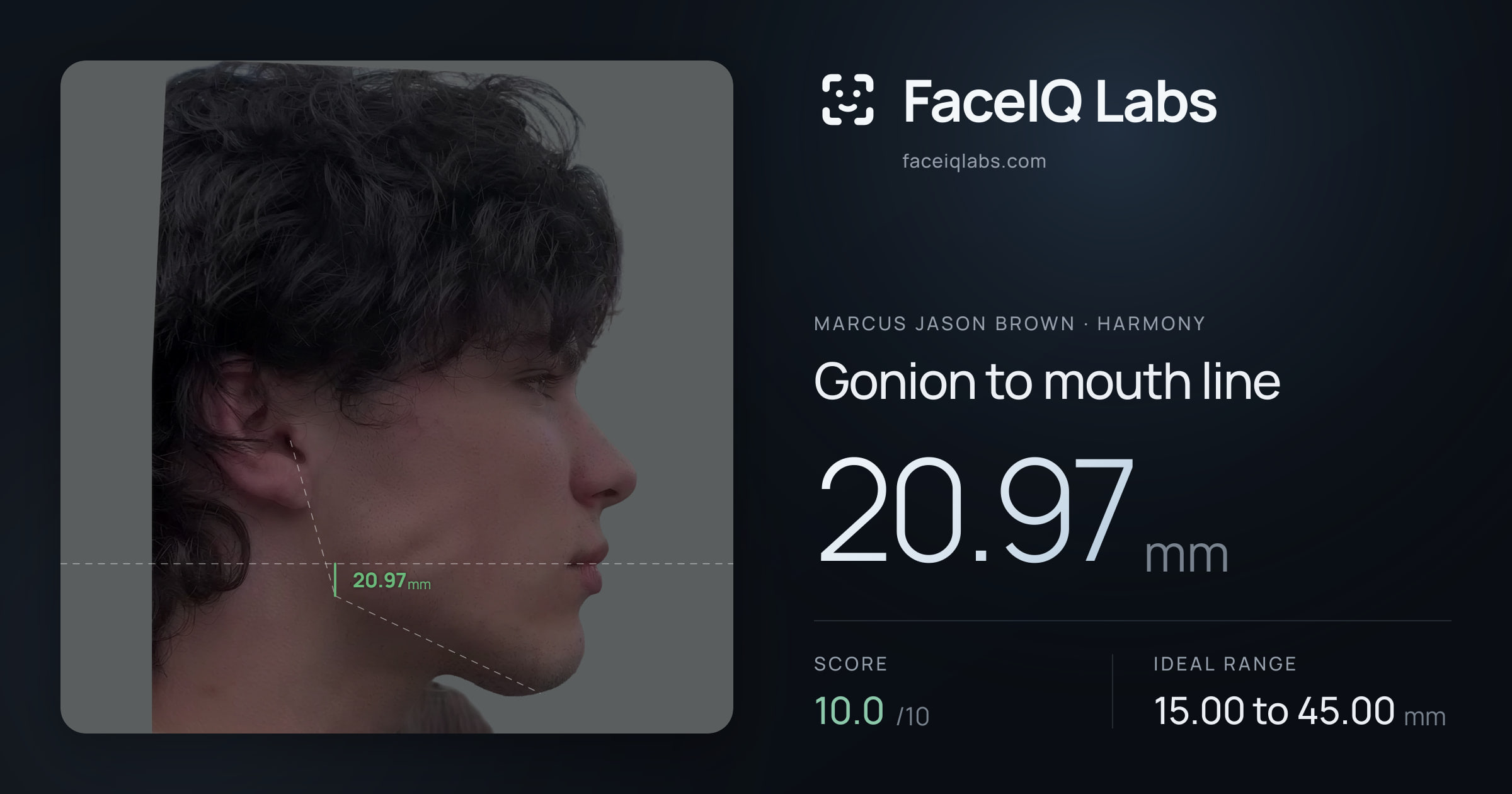 Marcus Jason Brown Gonion to mouth line: 20.97mm, drawn on the photo