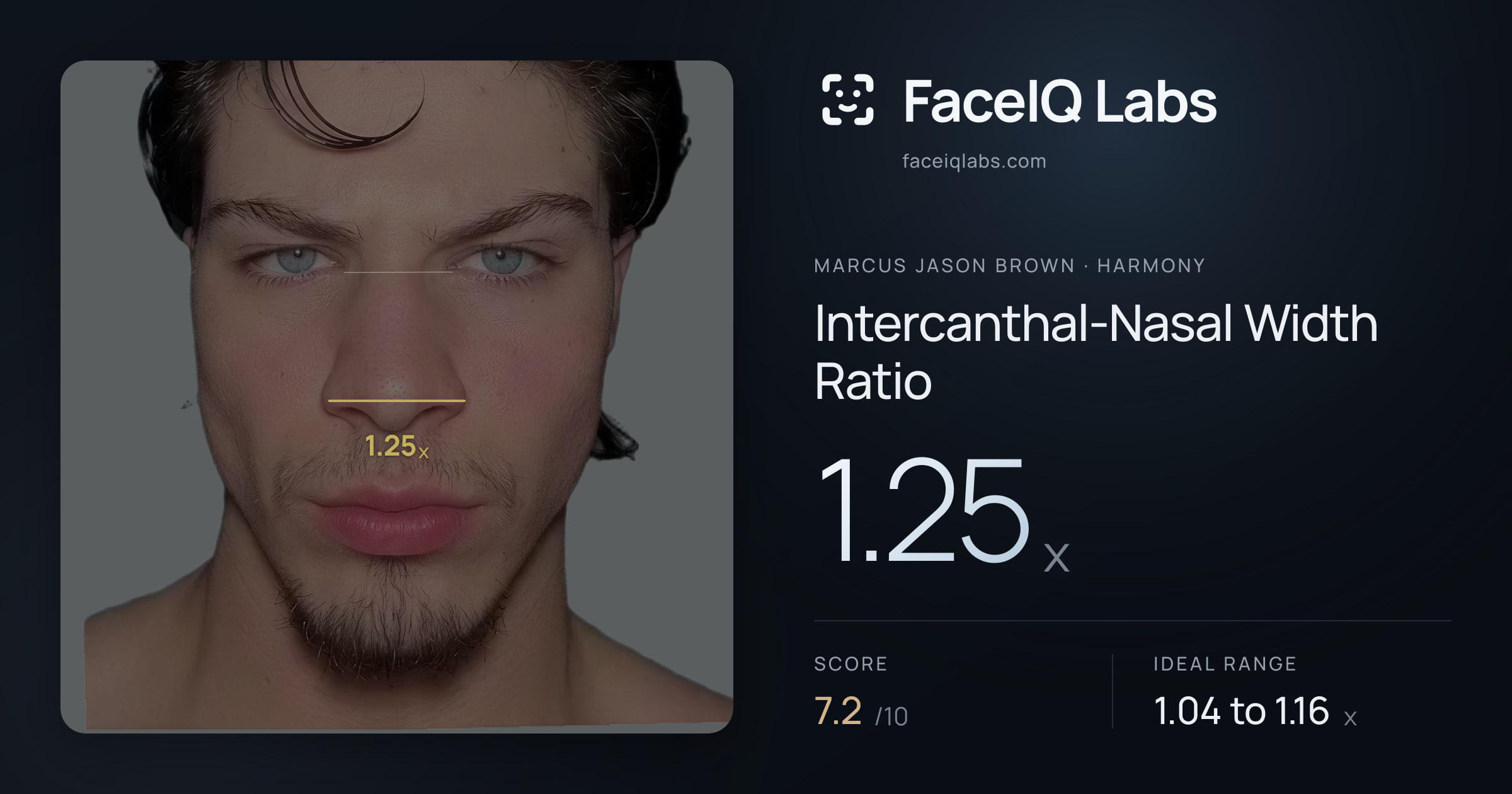 Marcus Jason Brown Intercanthal-Nasal Width Ratio: 1.25x, drawn on the photo