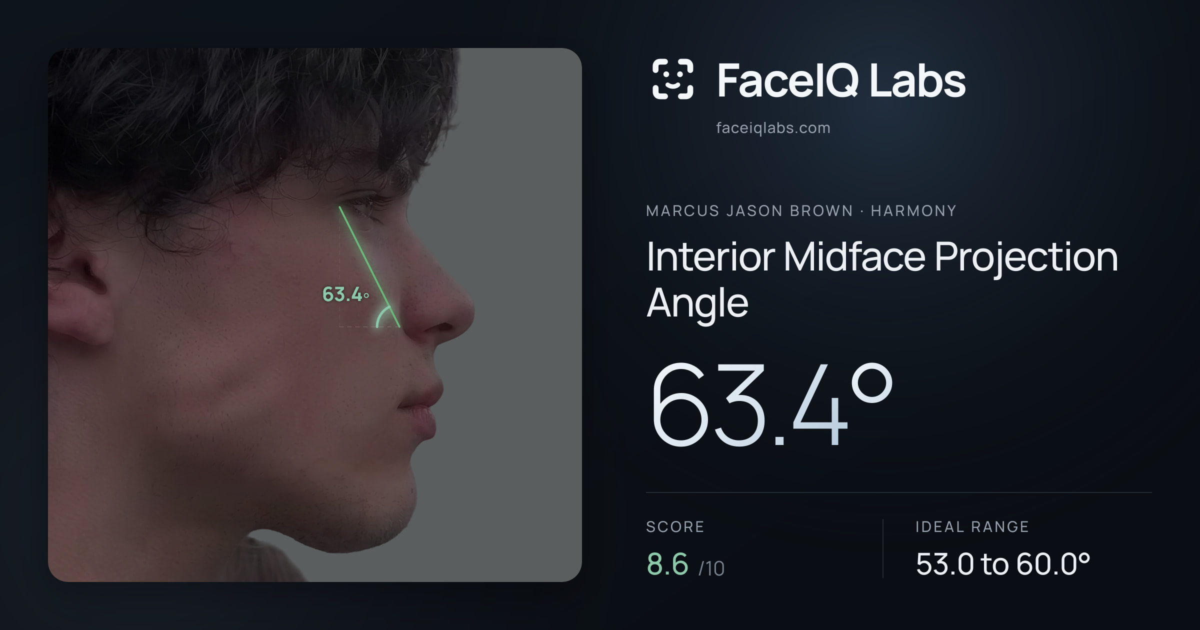 Marcus Jason Brown Interior Midface Projection Angle: 63.4°, drawn on the photo