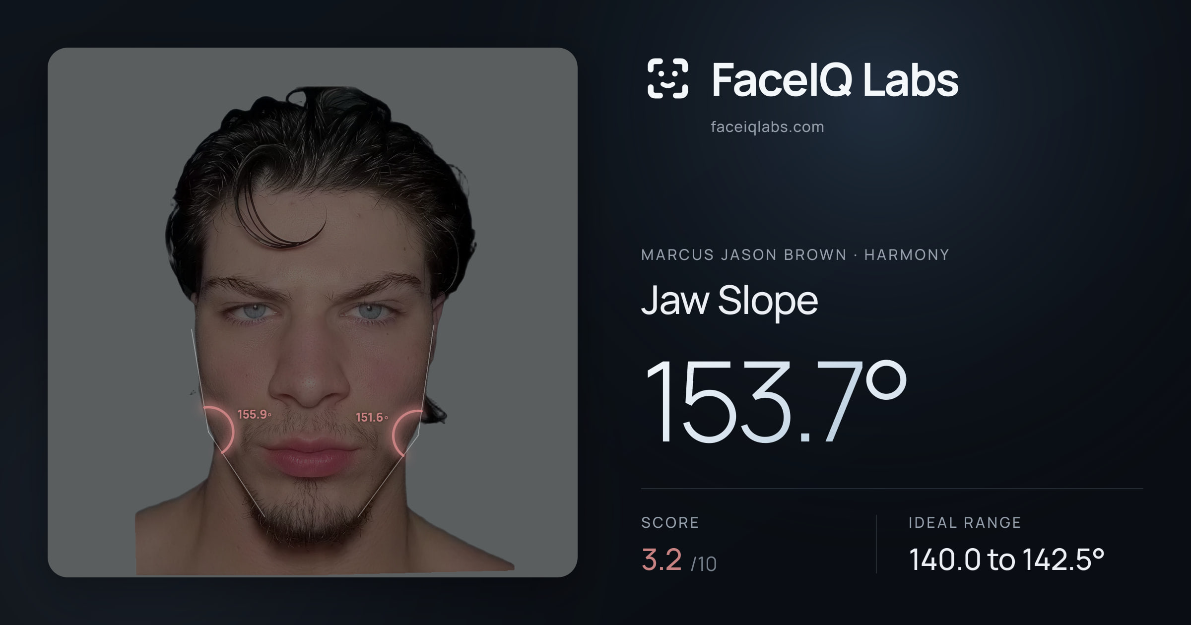 Marcus Jason Brown Jaw Slope: 153.7°, drawn on the photo