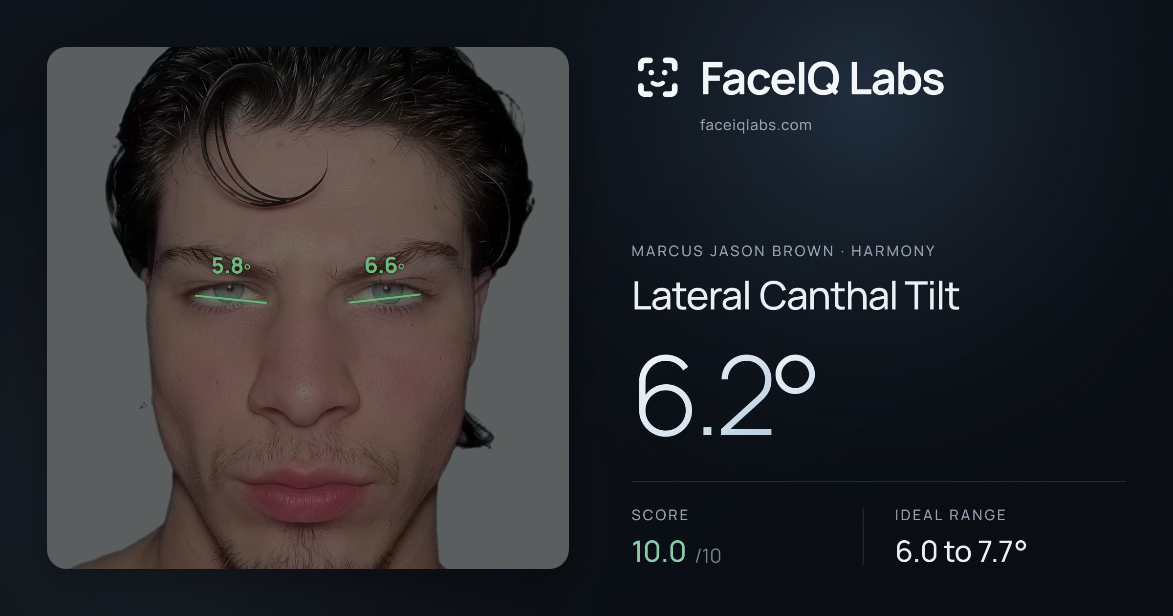 Marcus Jason Brown Lateral Canthal Tilt: 6.2°, drawn on the photo