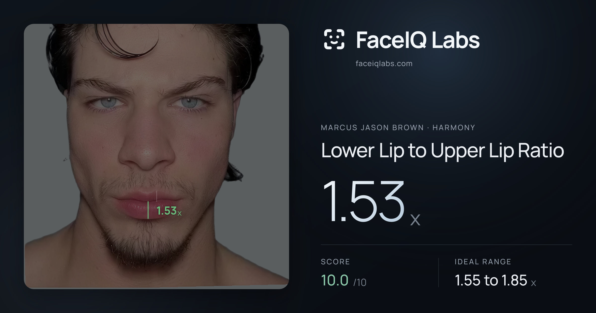 Marcus Jason Brown Lower Lip to Upper Lip Ratio: 1.53x, drawn on the photo