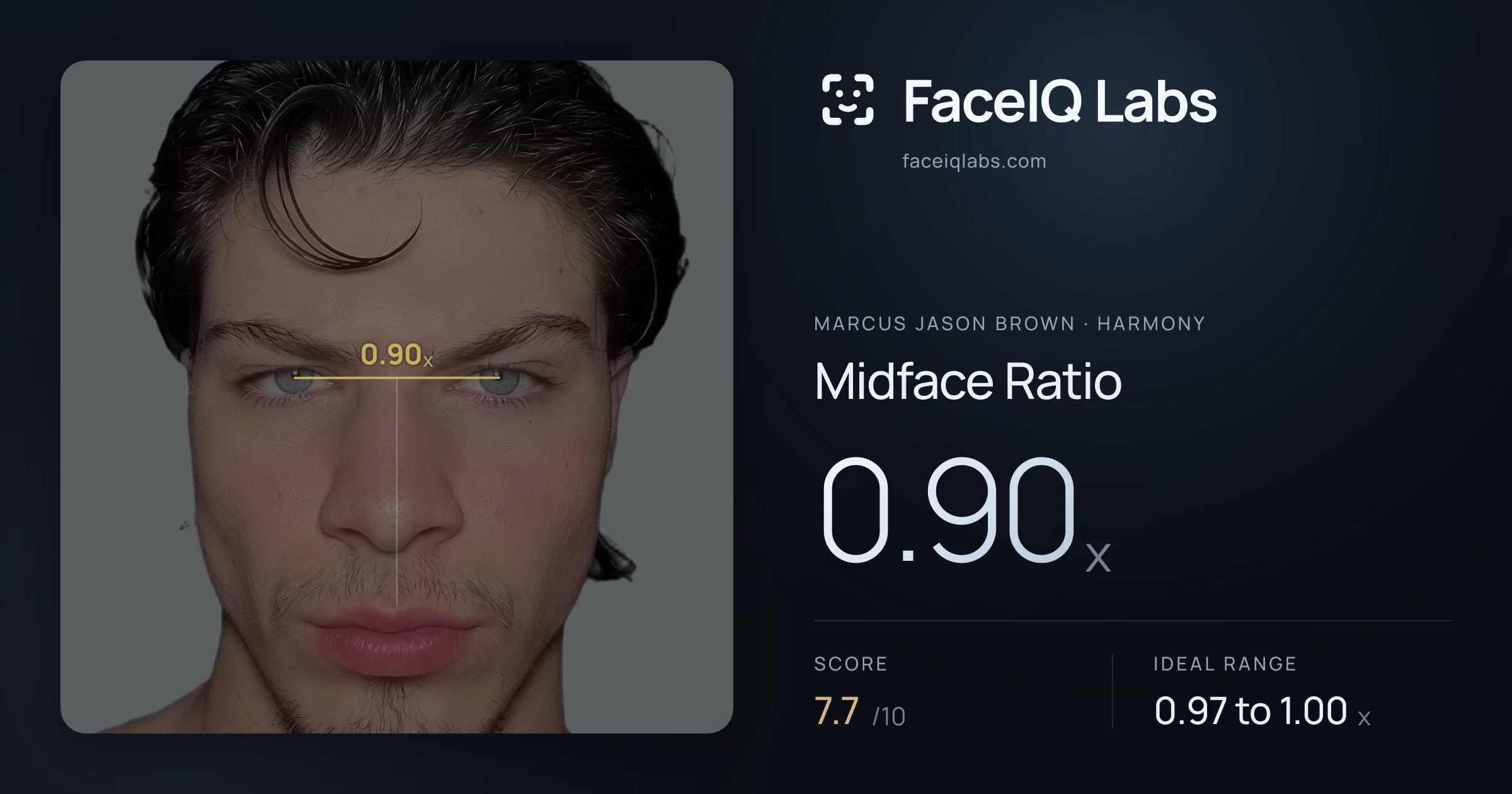 Marcus Jason Brown Midface Ratio: 0.90x, drawn on the photo