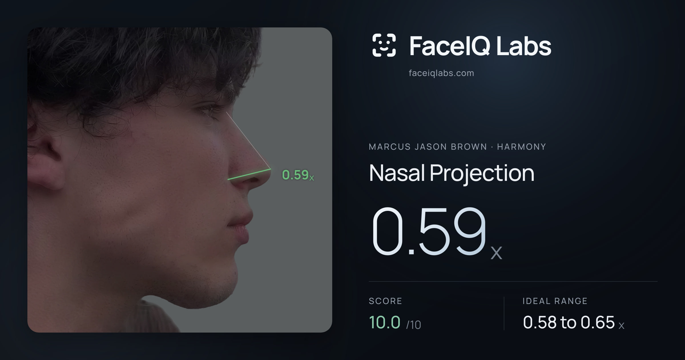 Marcus Jason Brown Nasal Projection: 0.59x, drawn on the photo