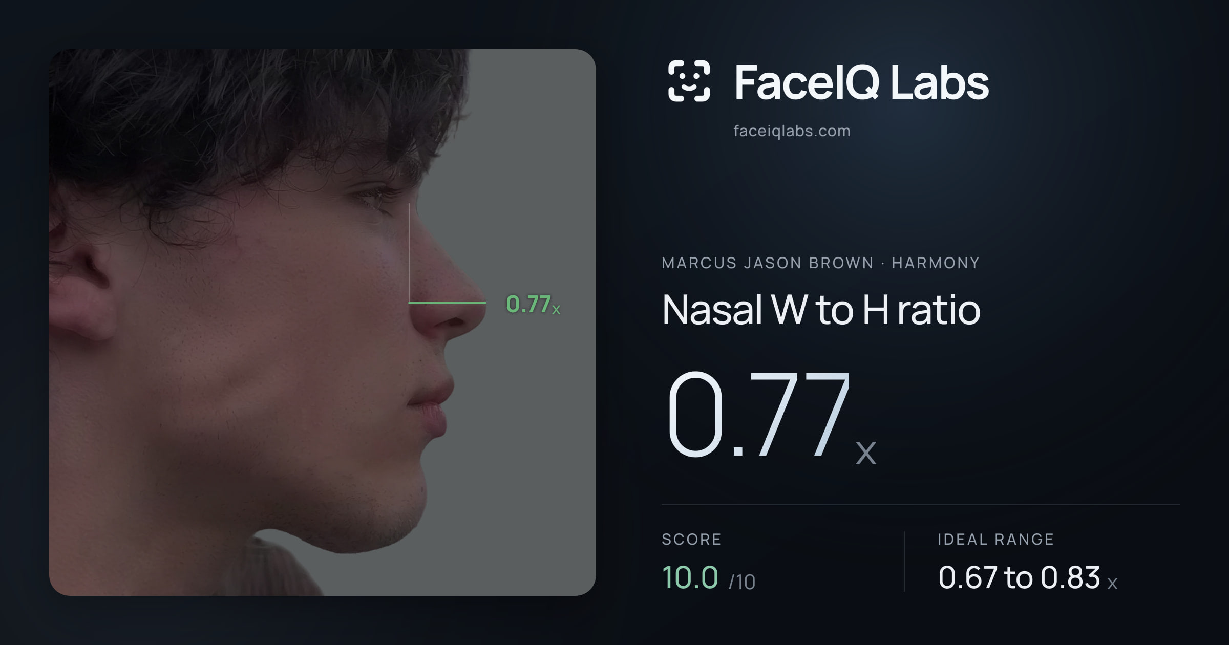 Marcus Jason Brown Nasal W to H ratio: 0.77x, drawn on the photo