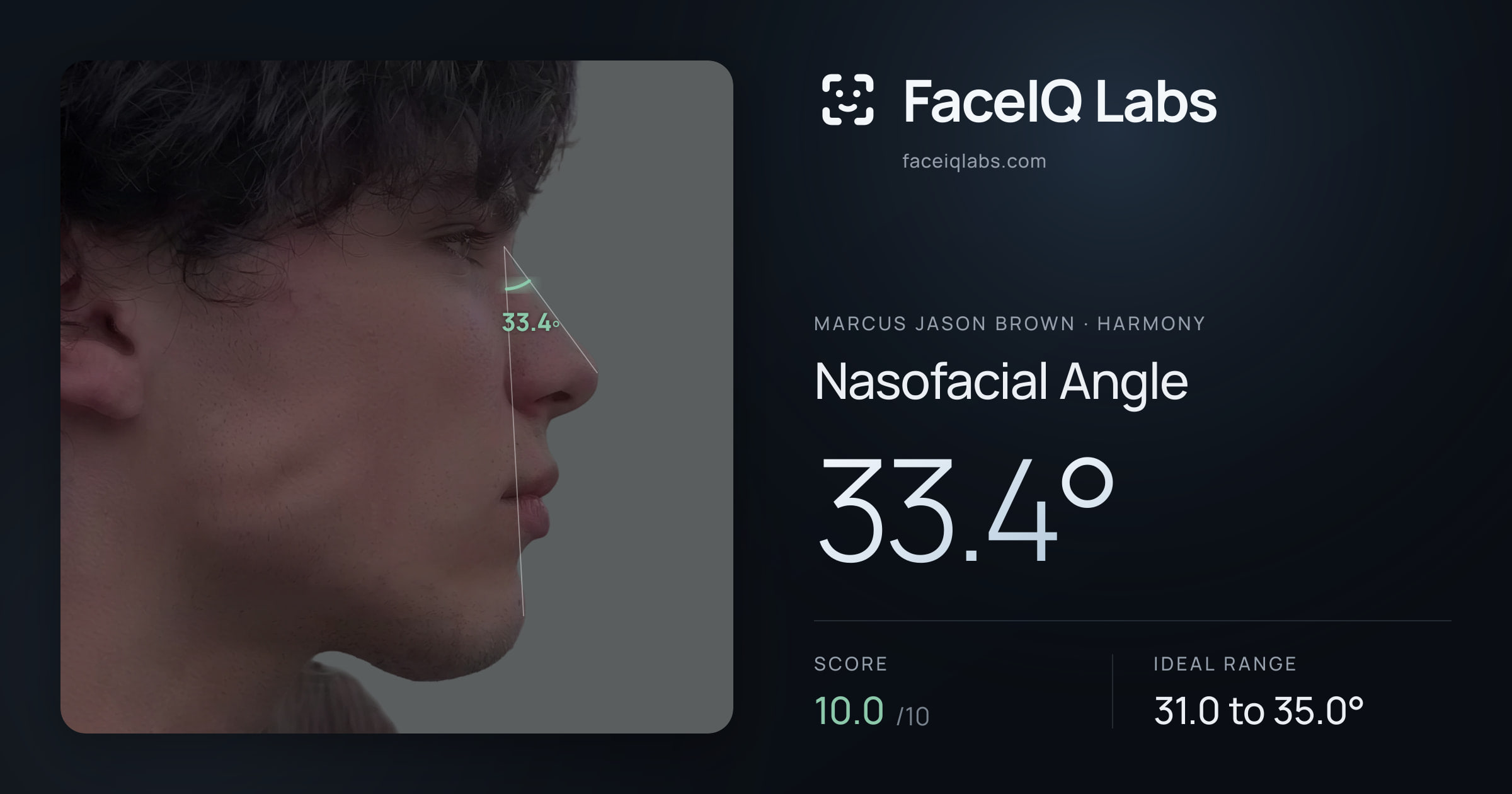 Marcus Jason Brown Nasofacial Angle: 33.4°, drawn on the photo