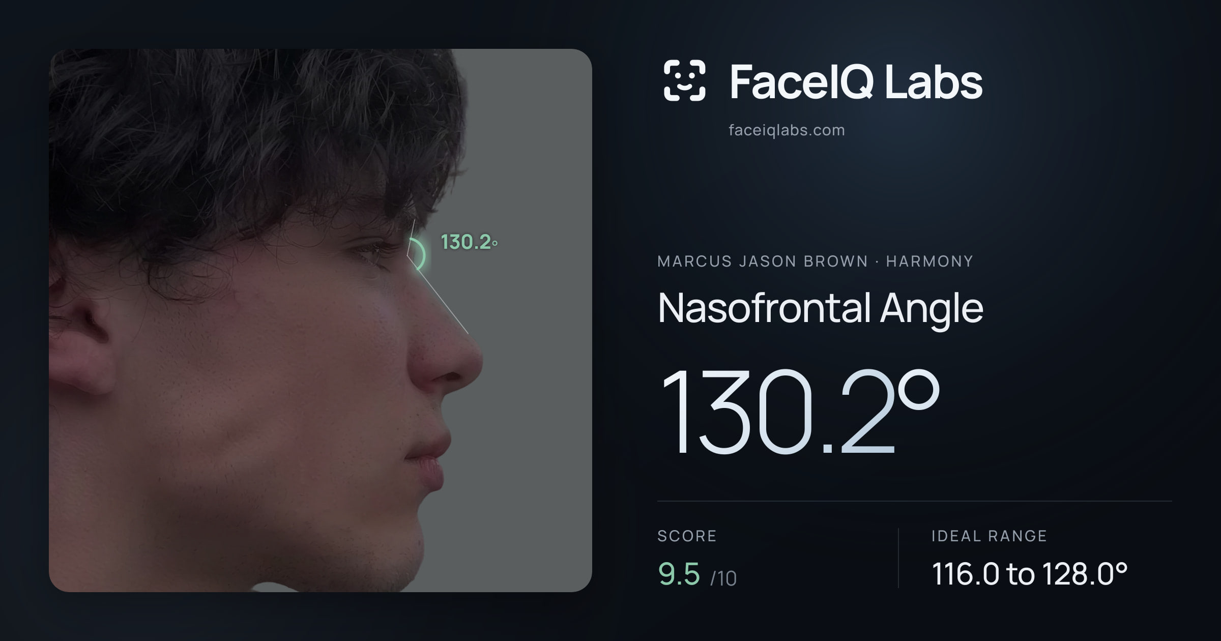 Marcus Jason Brown Nasofrontal Angle: 130.2°, drawn on the photo