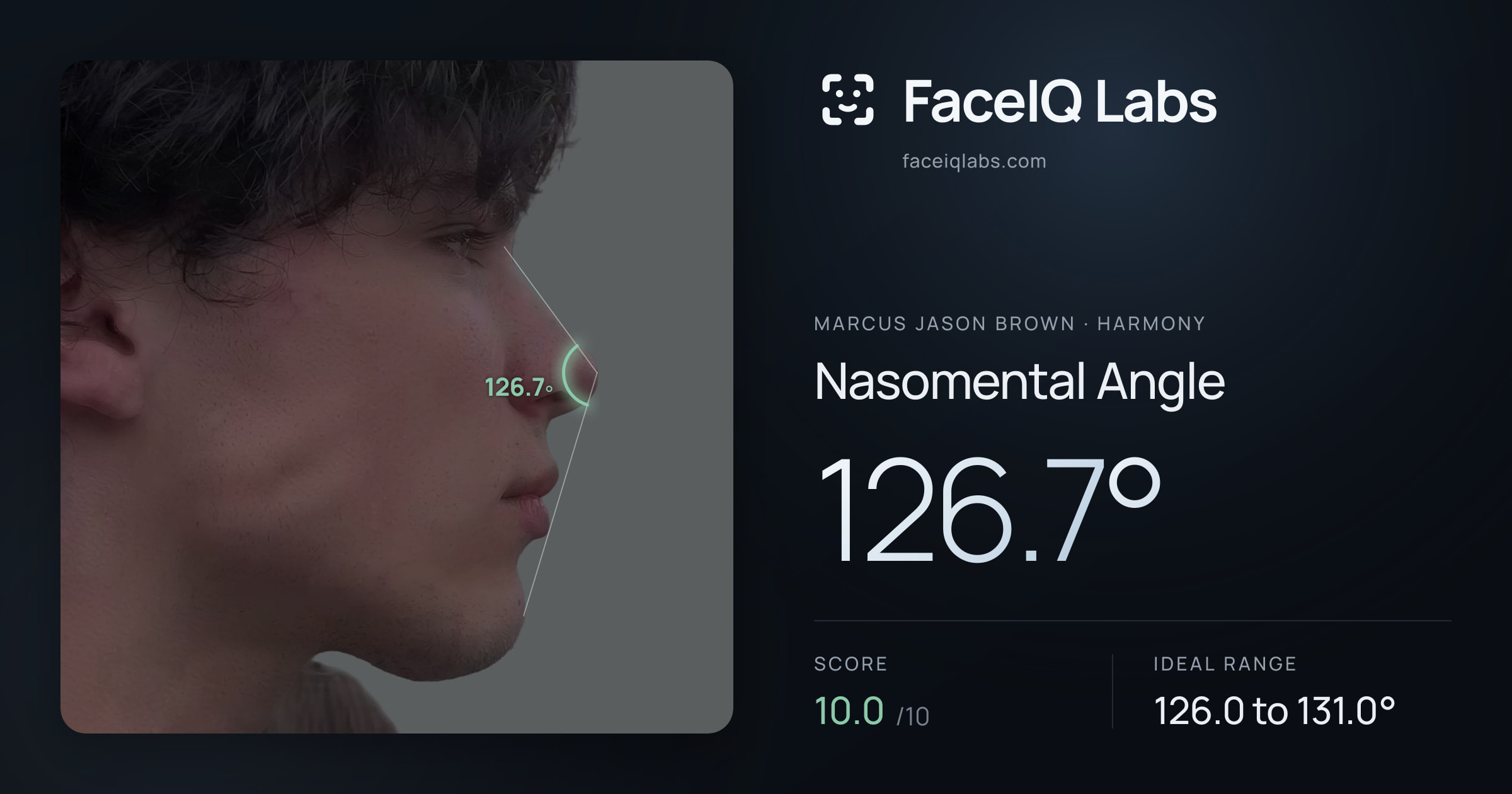 Marcus Jason Brown Nasomental Angle: 126.7°, drawn on the photo