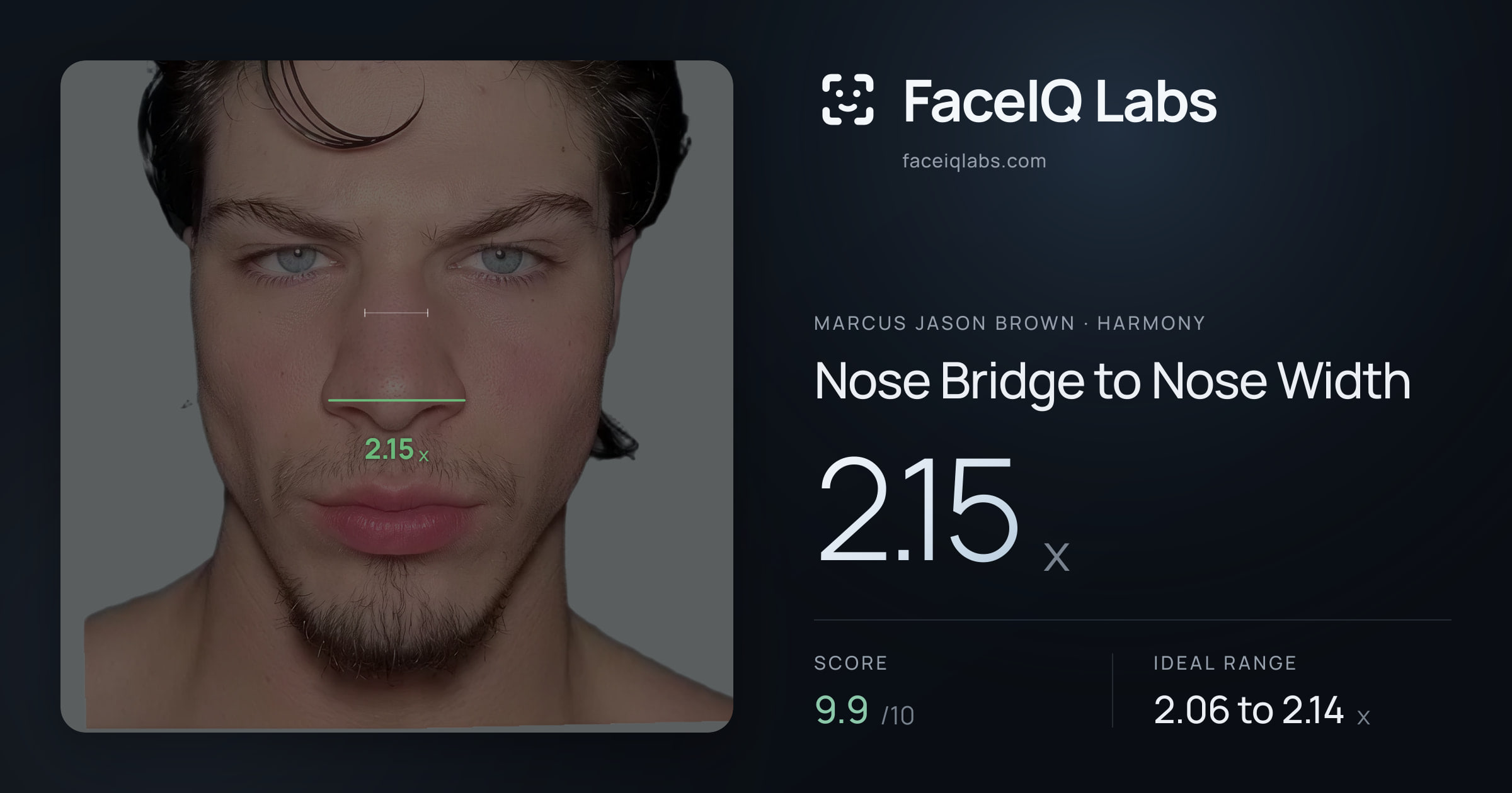 Marcus Jason Brown Nose Bridge to Nose Width: 2.15x, drawn on the photo
