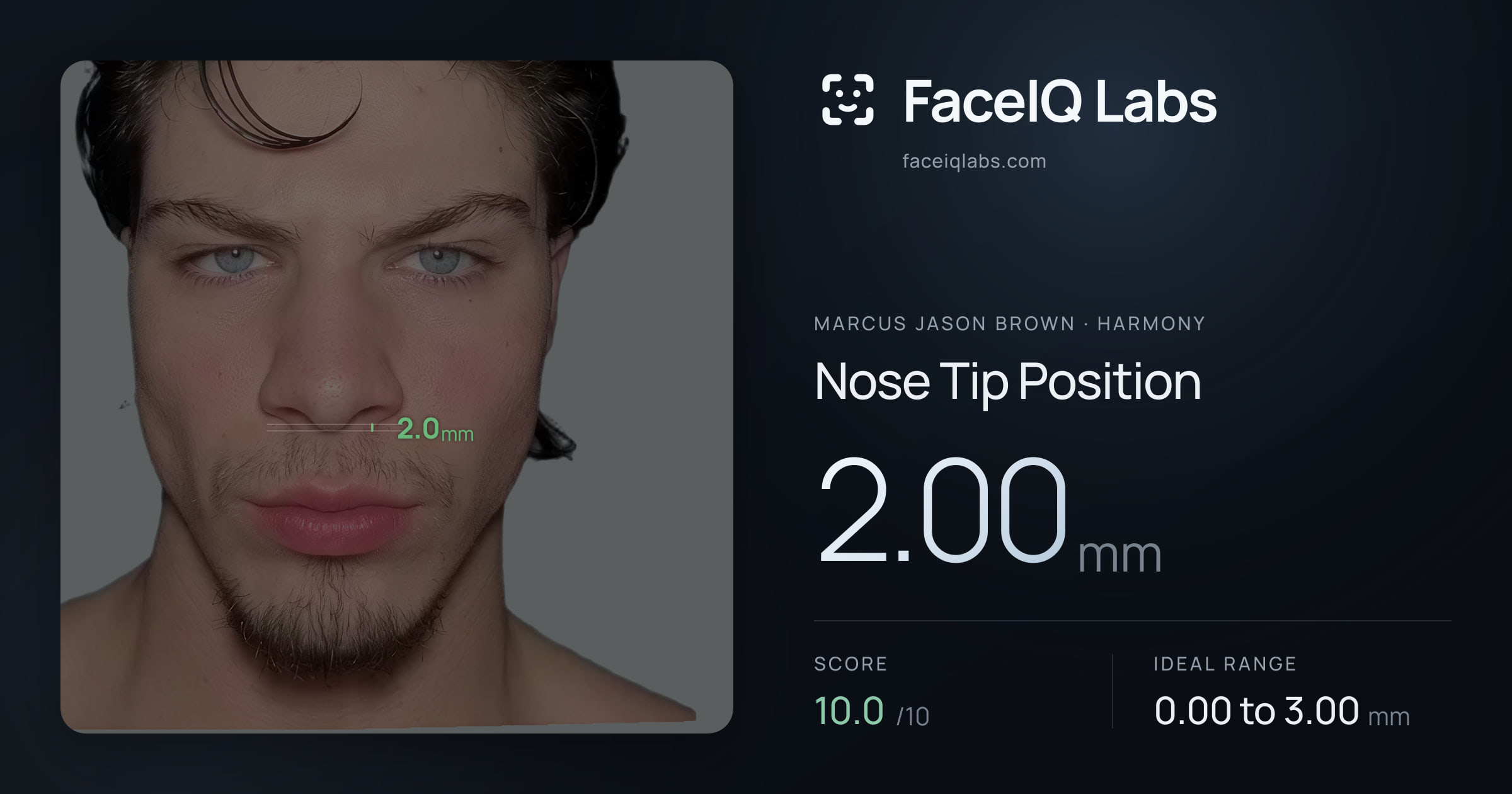 Marcus Jason Brown Nose Tip Position: 2.00mm, drawn on the photo