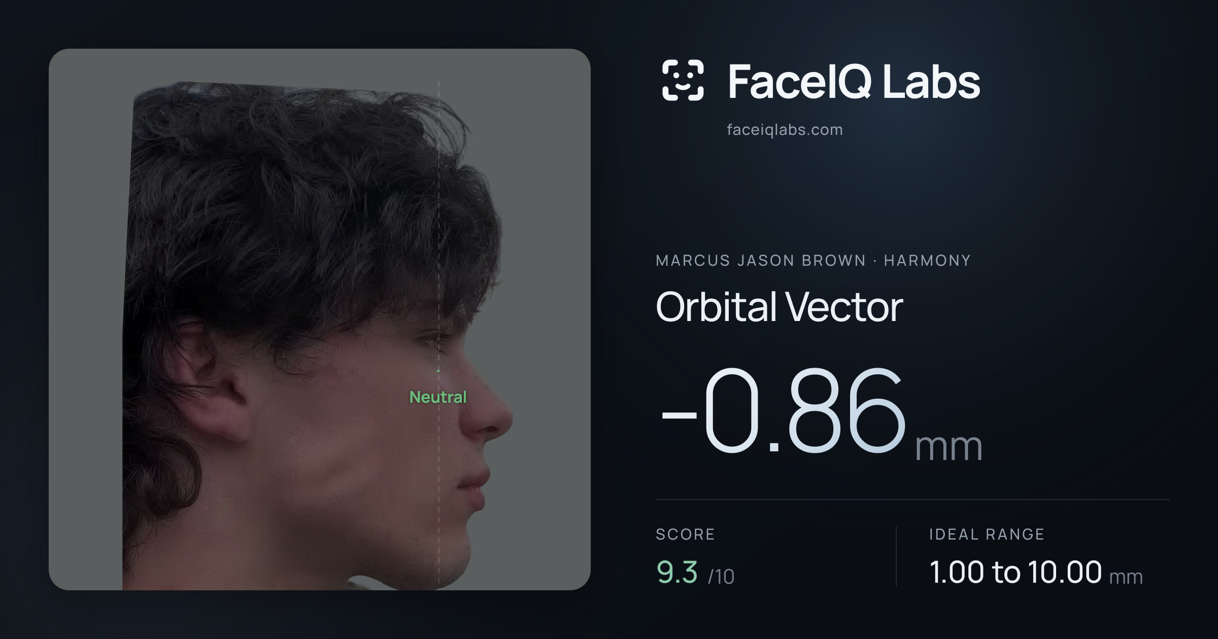 Marcus Jason Brown Orbital Vector: -0.86mm, drawn on the photo