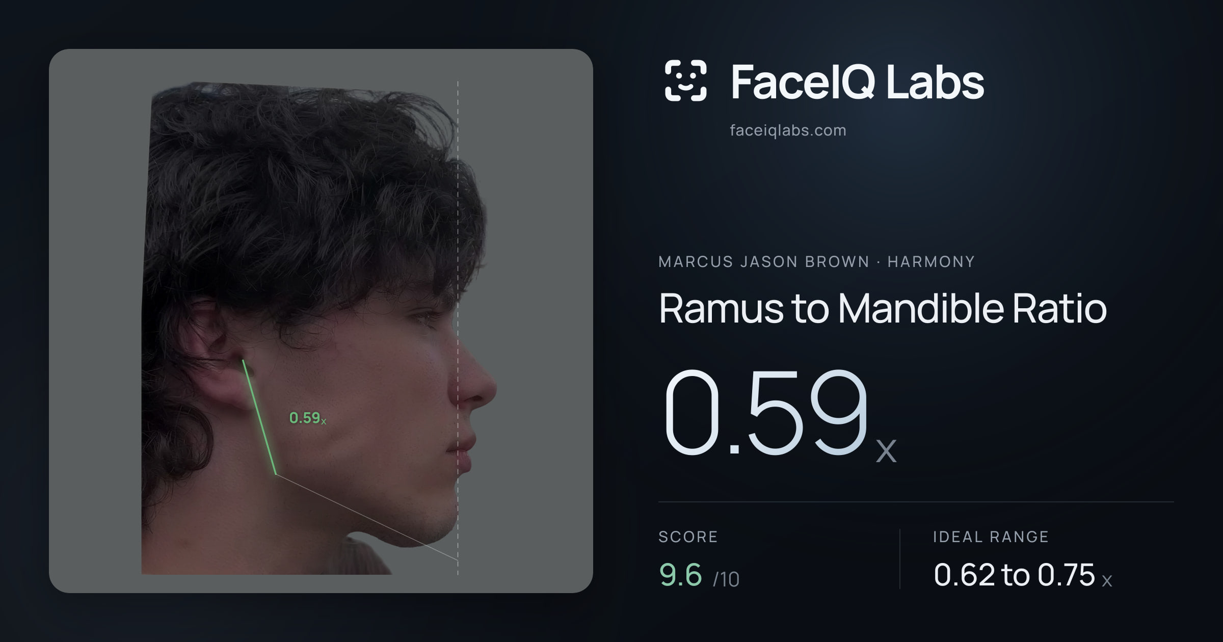 Marcus Jason Brown Ramus to Mandible Ratio: 0.59x, drawn on the photo